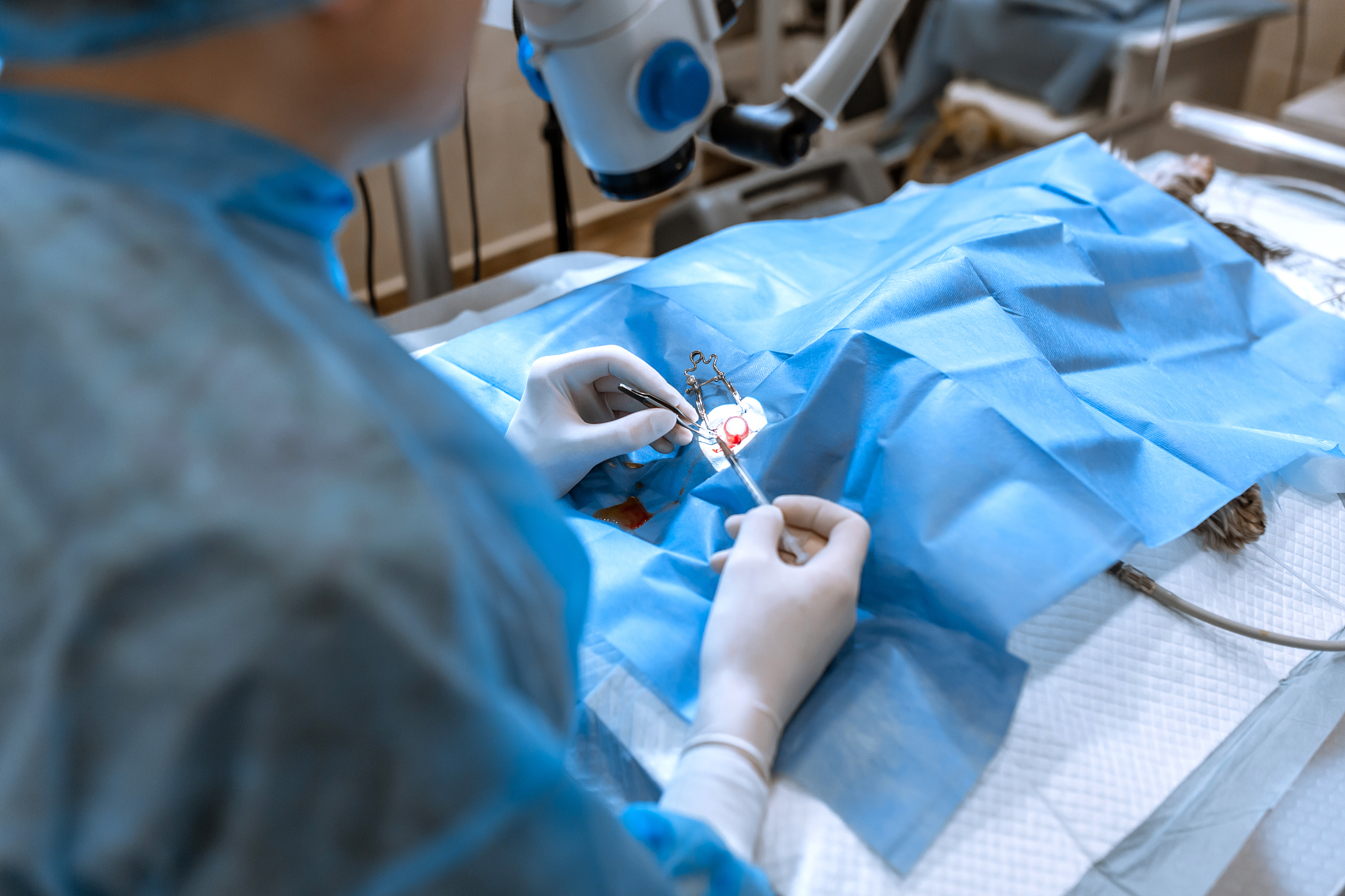 a professional ophthalmologist performs eye surgery with a micro