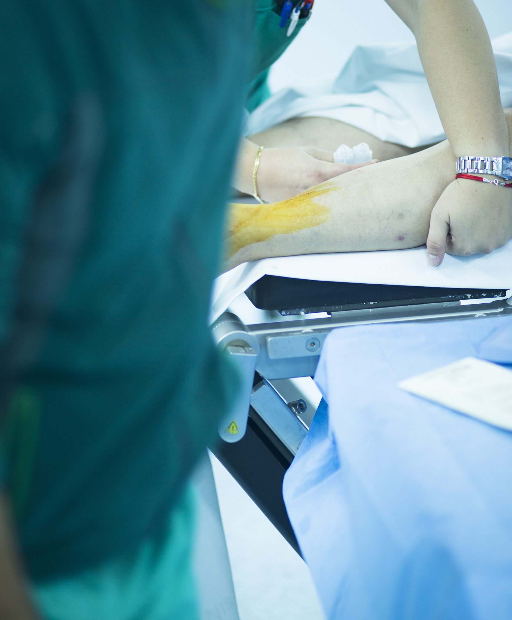 微创组织松解器：抽脂术后修复及组织粘连治疗的新方案