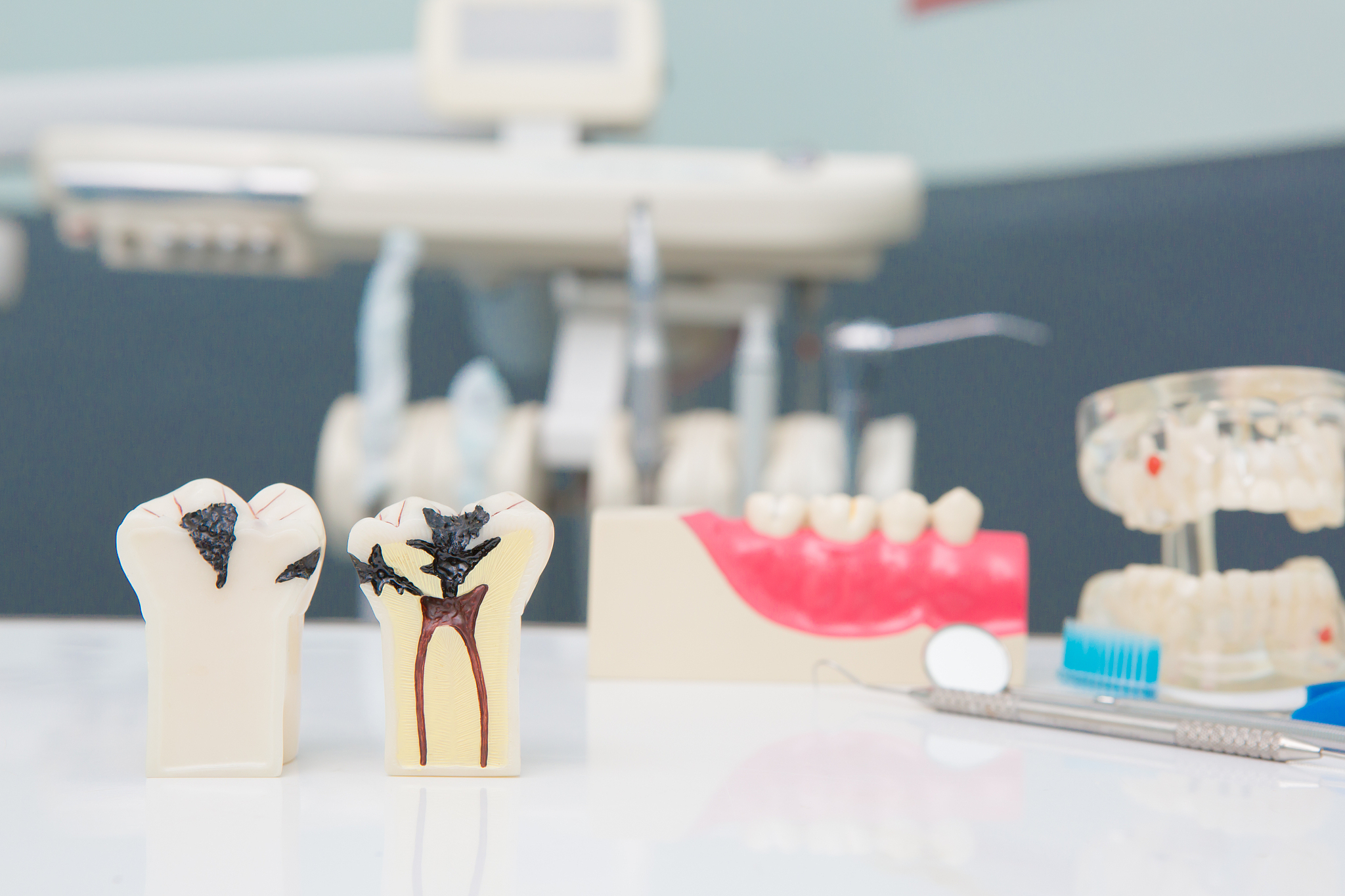 单层曝光时间对齿科模型质量的影响