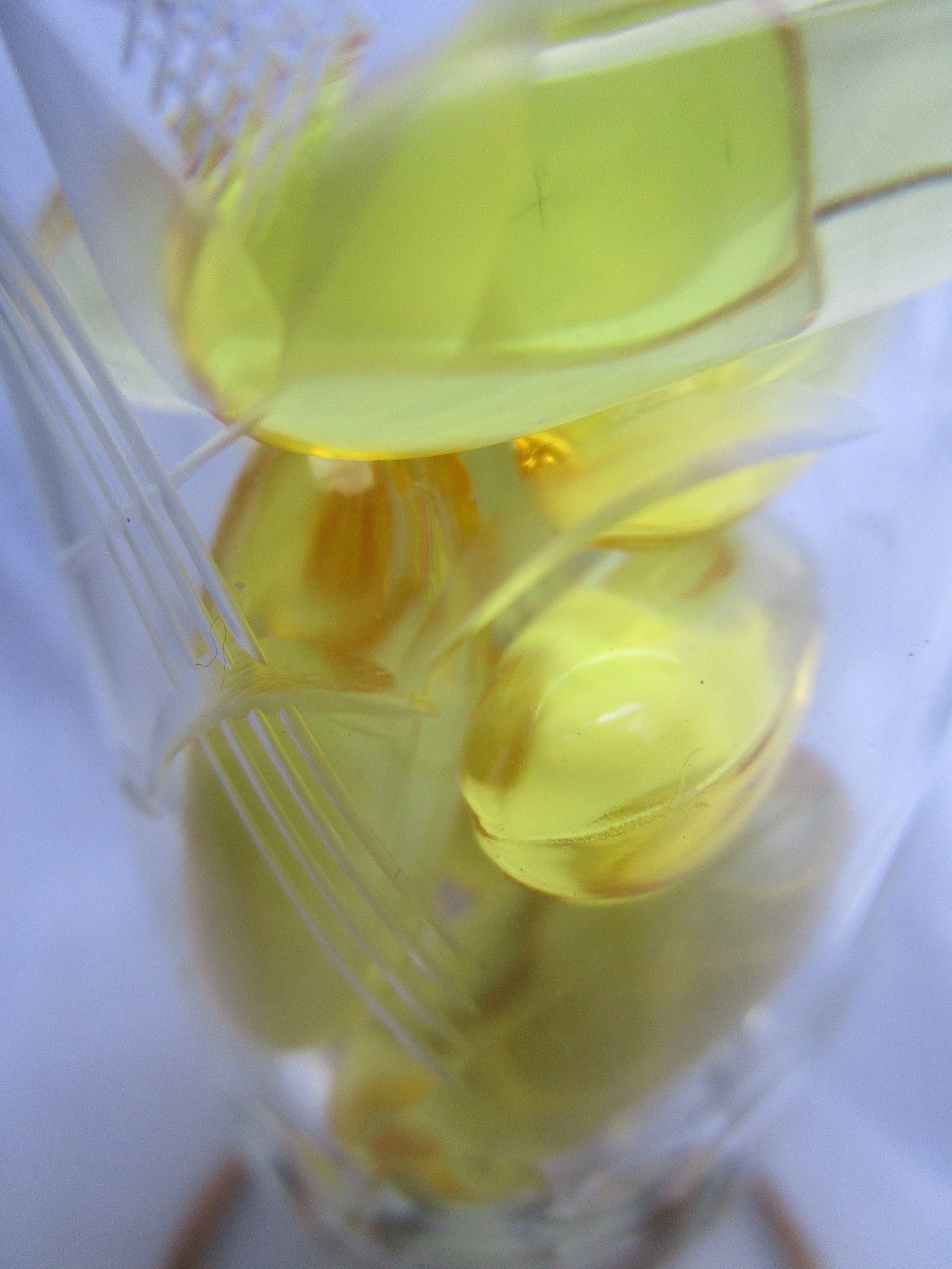 男性射精后尿液泡沫多？原因分析及注意事项