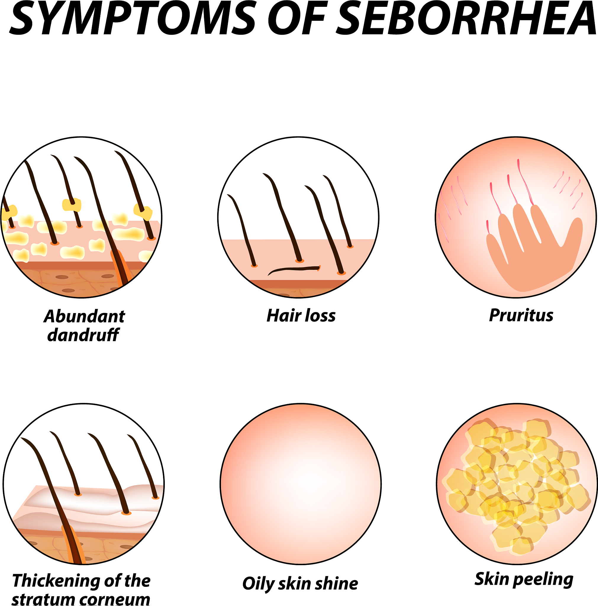 Papule: Definition, Causes, Treatment - Skin Bump Explained