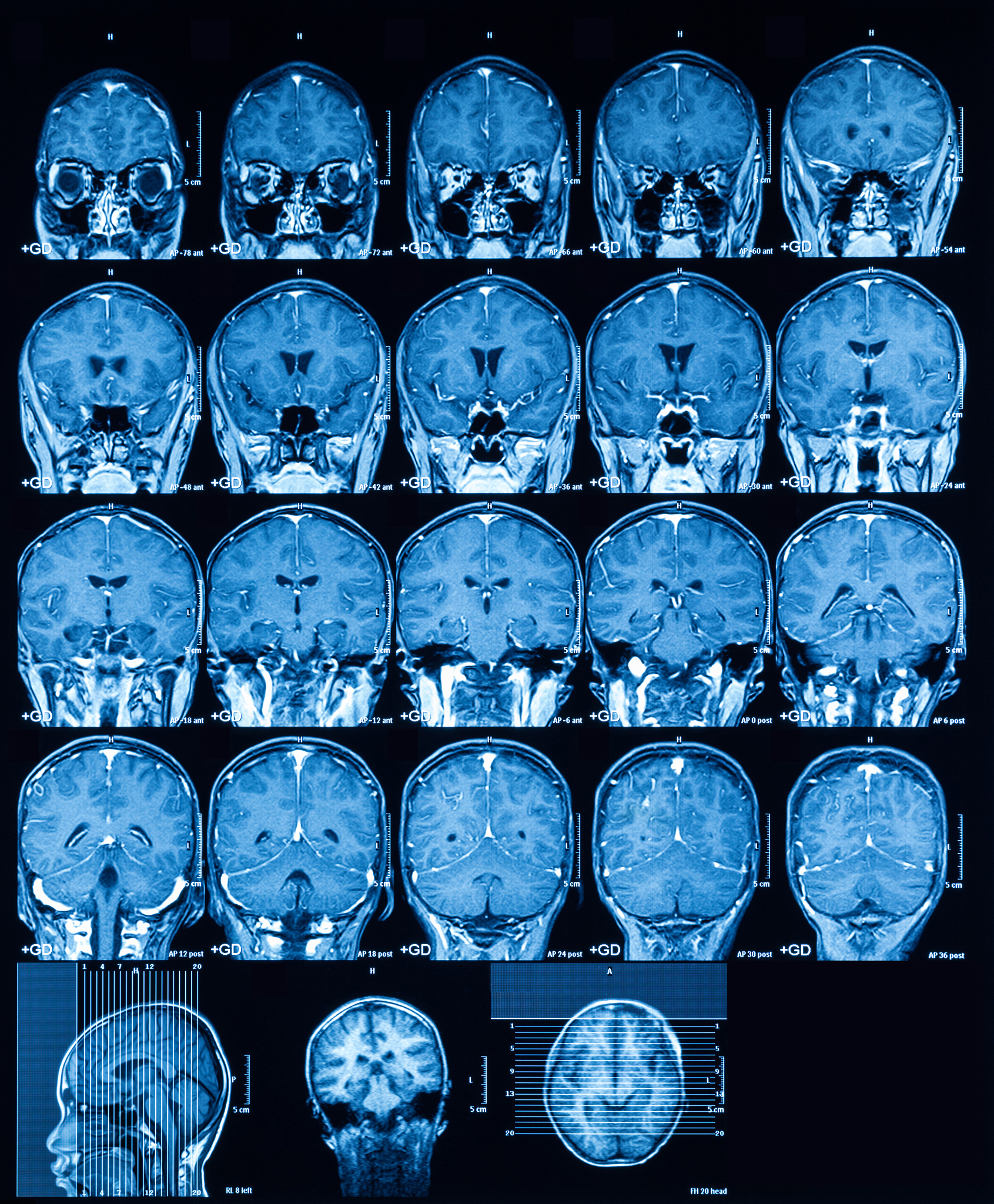 新型分子影像学技术：未来生物医学研究的利器