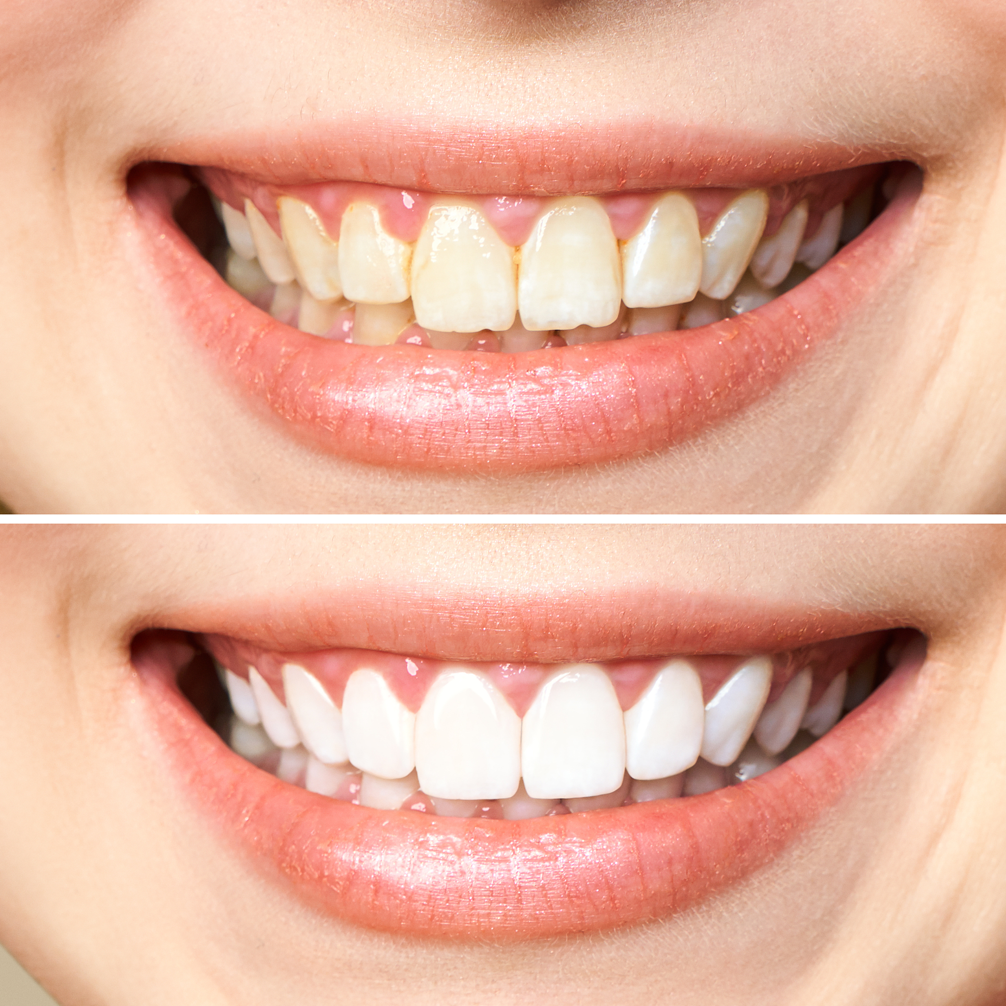 10 Incredible Cosmetic Dentistry Benefits That Will Transform Your Smile