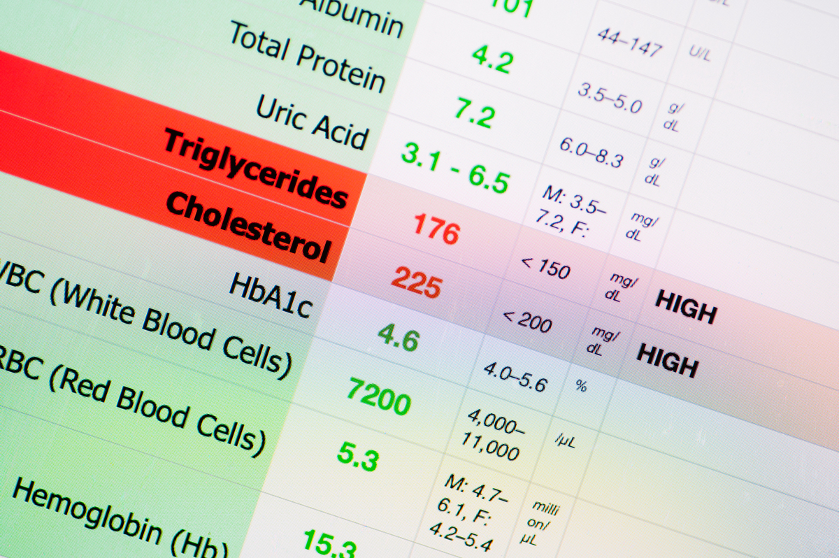 高脂血症的5大特征及危害，你了解多少？