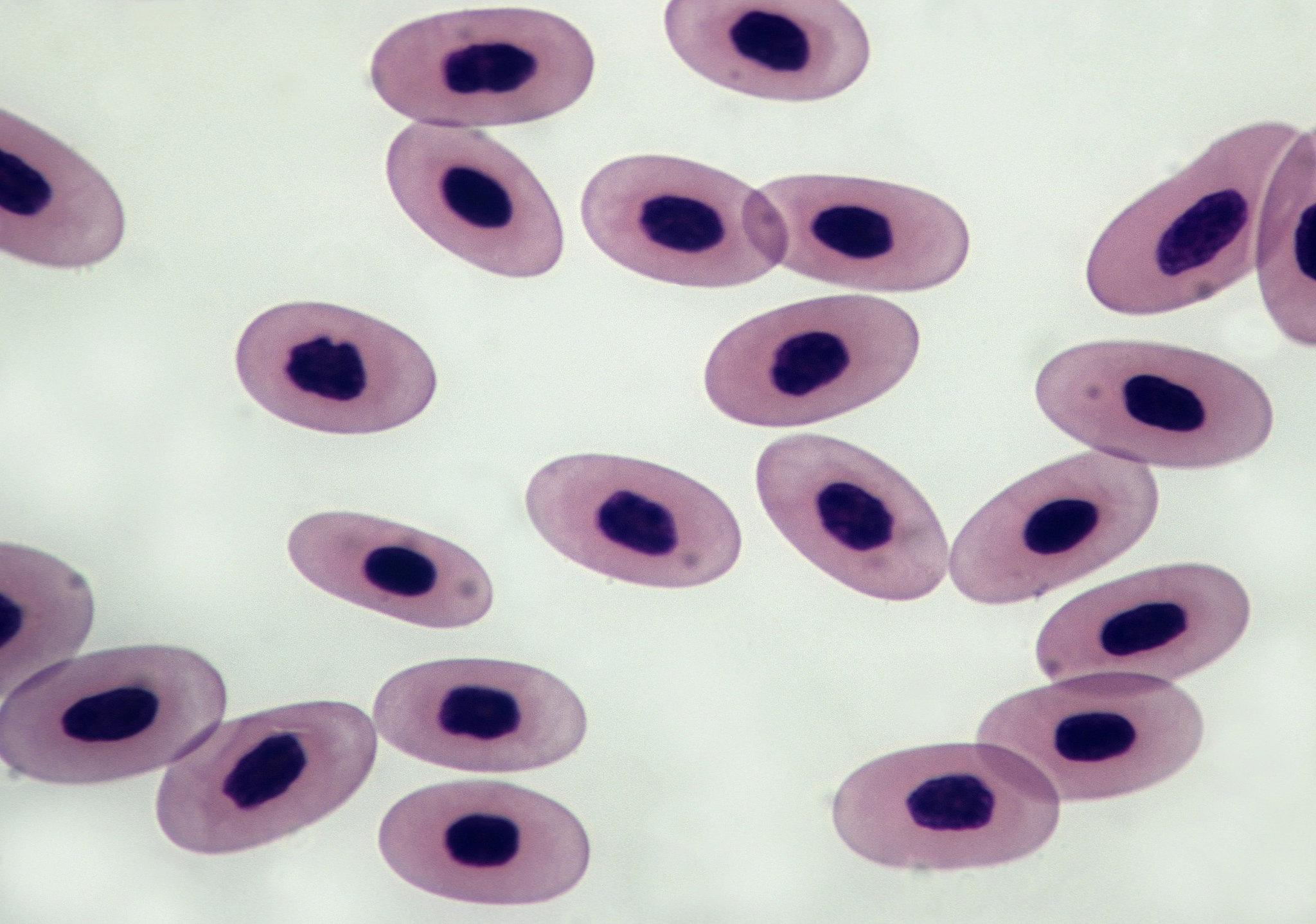 1阴、阳离子及中性去污剂对细胞膜稳定性的影响如何？原因是什么？