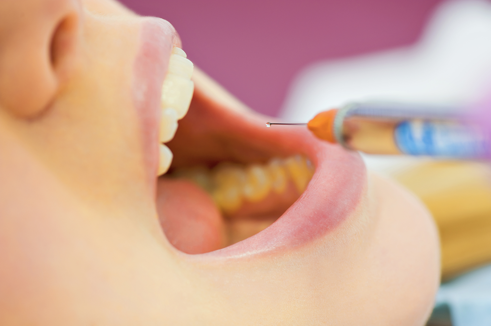 牙龈肿痛怎么办