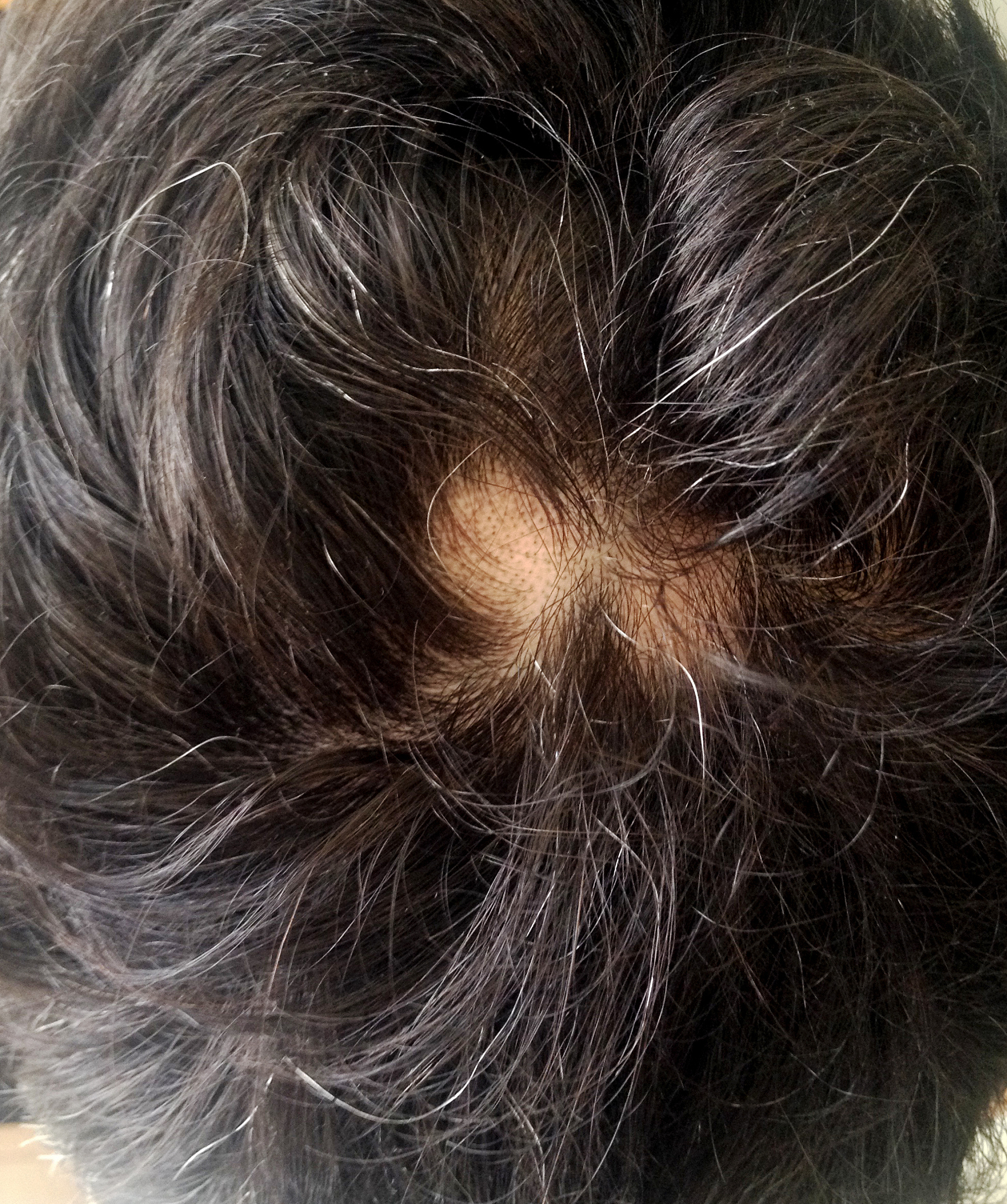 21岁女生，100根白发一个月能变黑吗？科学家教你自然黑发秘诀！