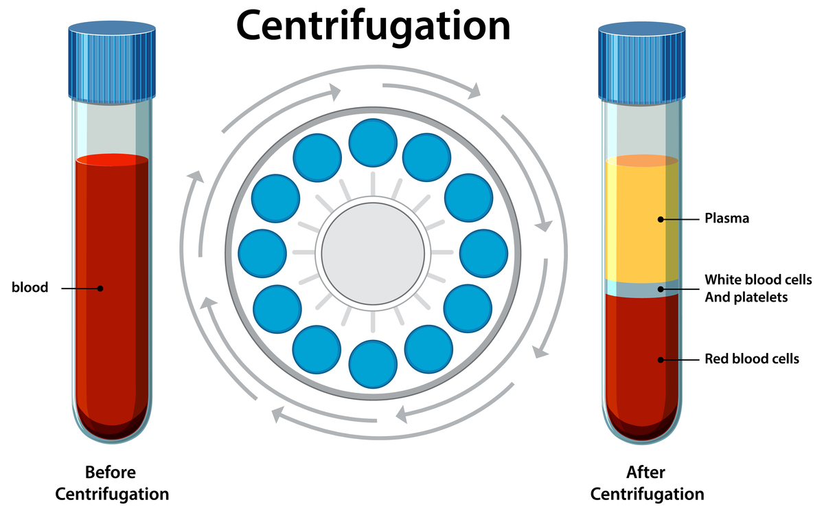 pltplotmodelalphas_ modelcoef_ marker=opltxlabelalphapltylabelcoefficientsplttitleLasso coefficientspltxticksmodelalphas_10 # 将x轴刻度设置为每10个alpha值显示一次pltshow出现x and y must have same first dimension but have shapes 100 and 684这个错误怎么解决