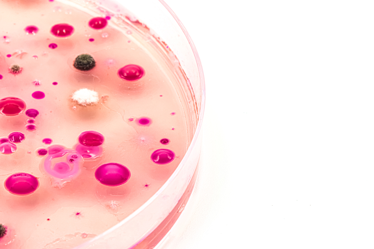 基本培养基和完全培养基的区别：如何选择合适的细菌培养基？