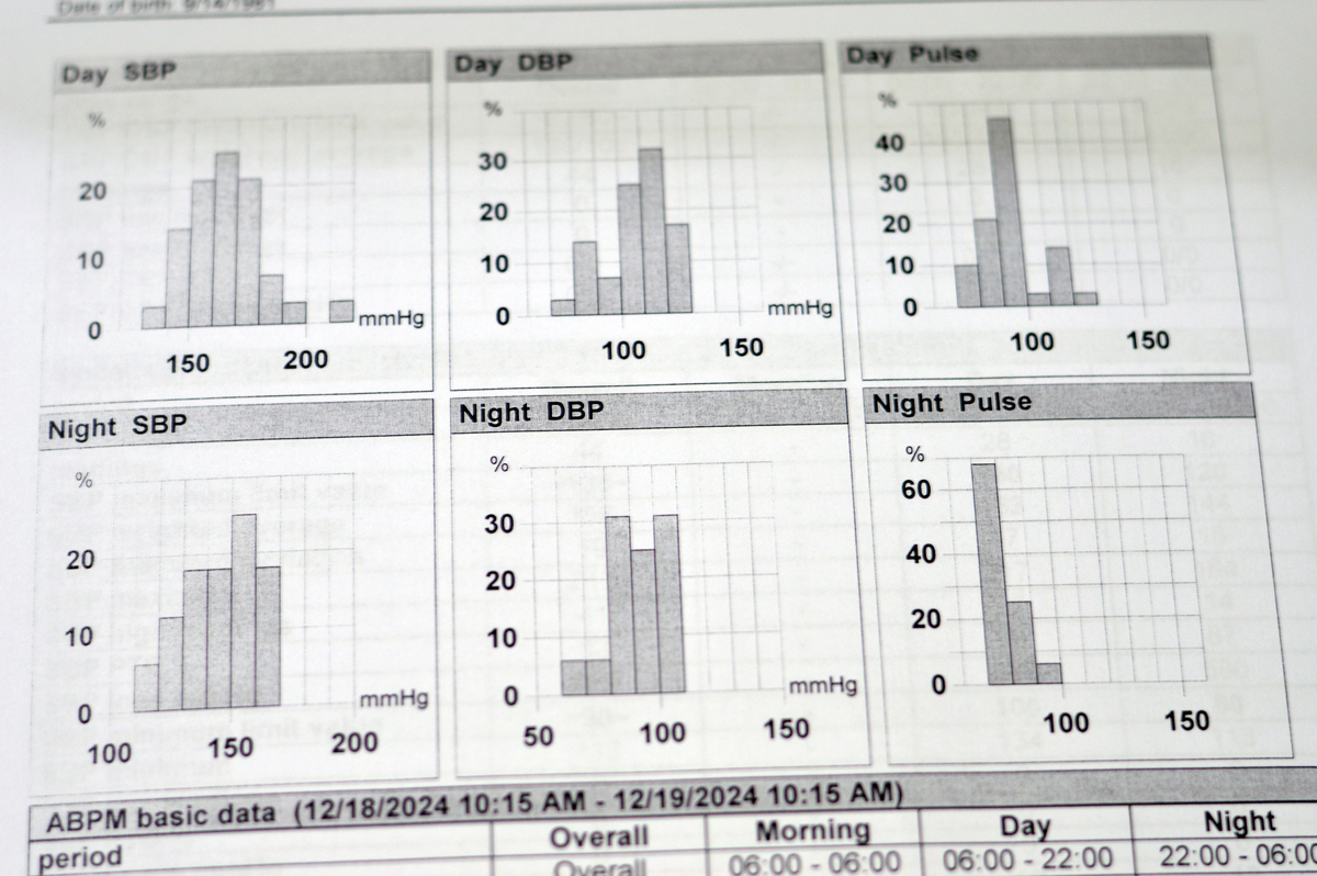 Goods Exposed to High Temperatures: Investigating the Timeline
