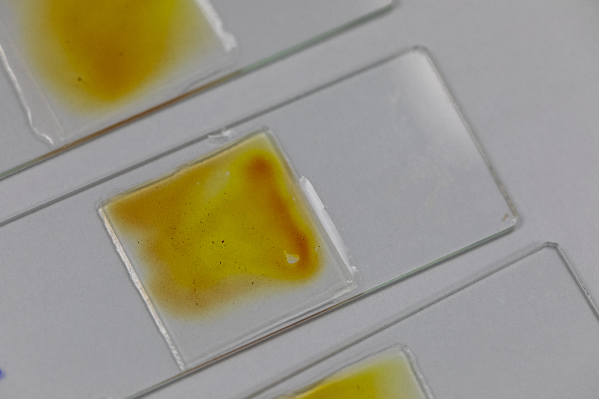 写1篇日记。关于四年级学生小明上学时感染肠腺病毒拉肚子一整天拉肚子十几次。最严重一次在厕所泻了一节课时间同学们都很担心。重点刻画拉肚子痛苦、肚子咕噜的声音拉出稀黄水蛋花状物