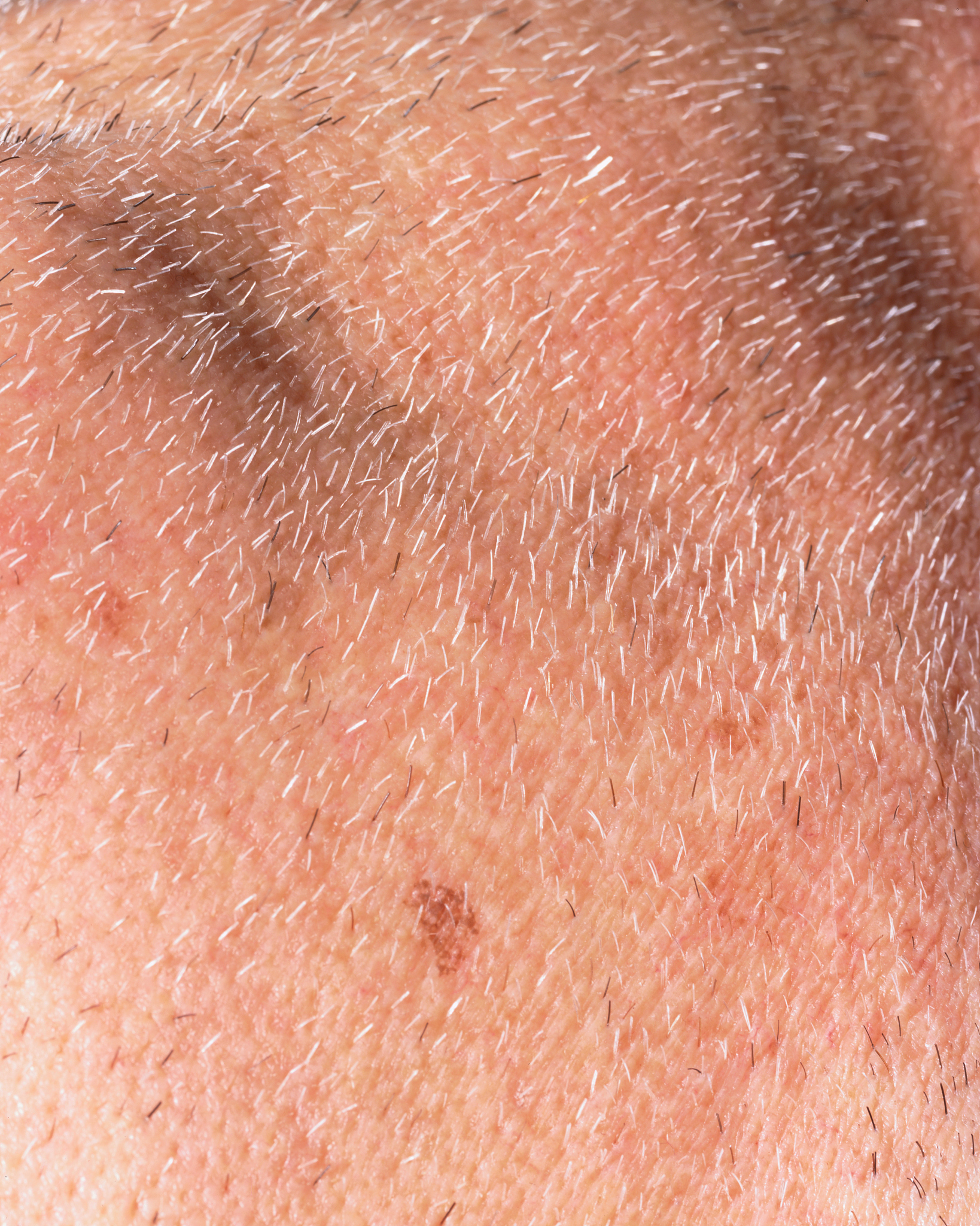 skin with stubble