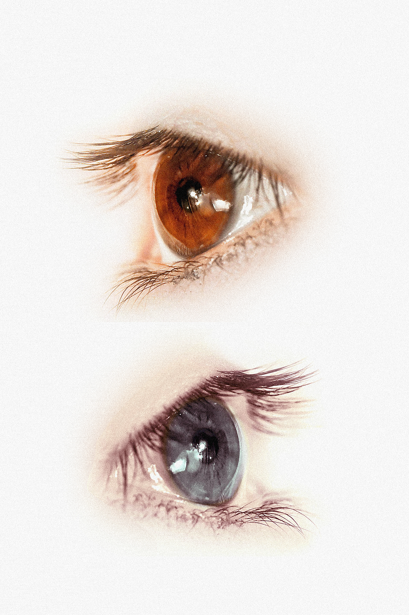 eye