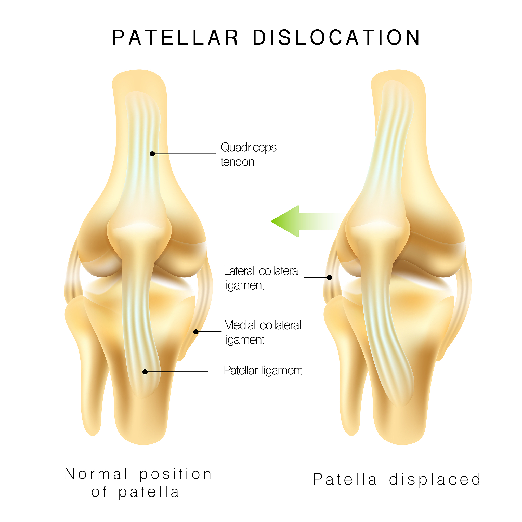 狗狗髌骨位置解析：详解结构、功能和常见问题