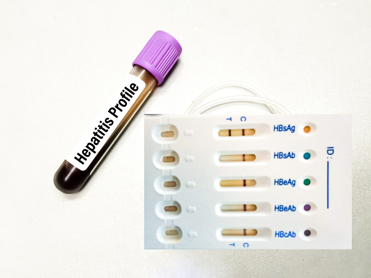 新甘舒林胰岛素注射笔：用法、优势及注意事项