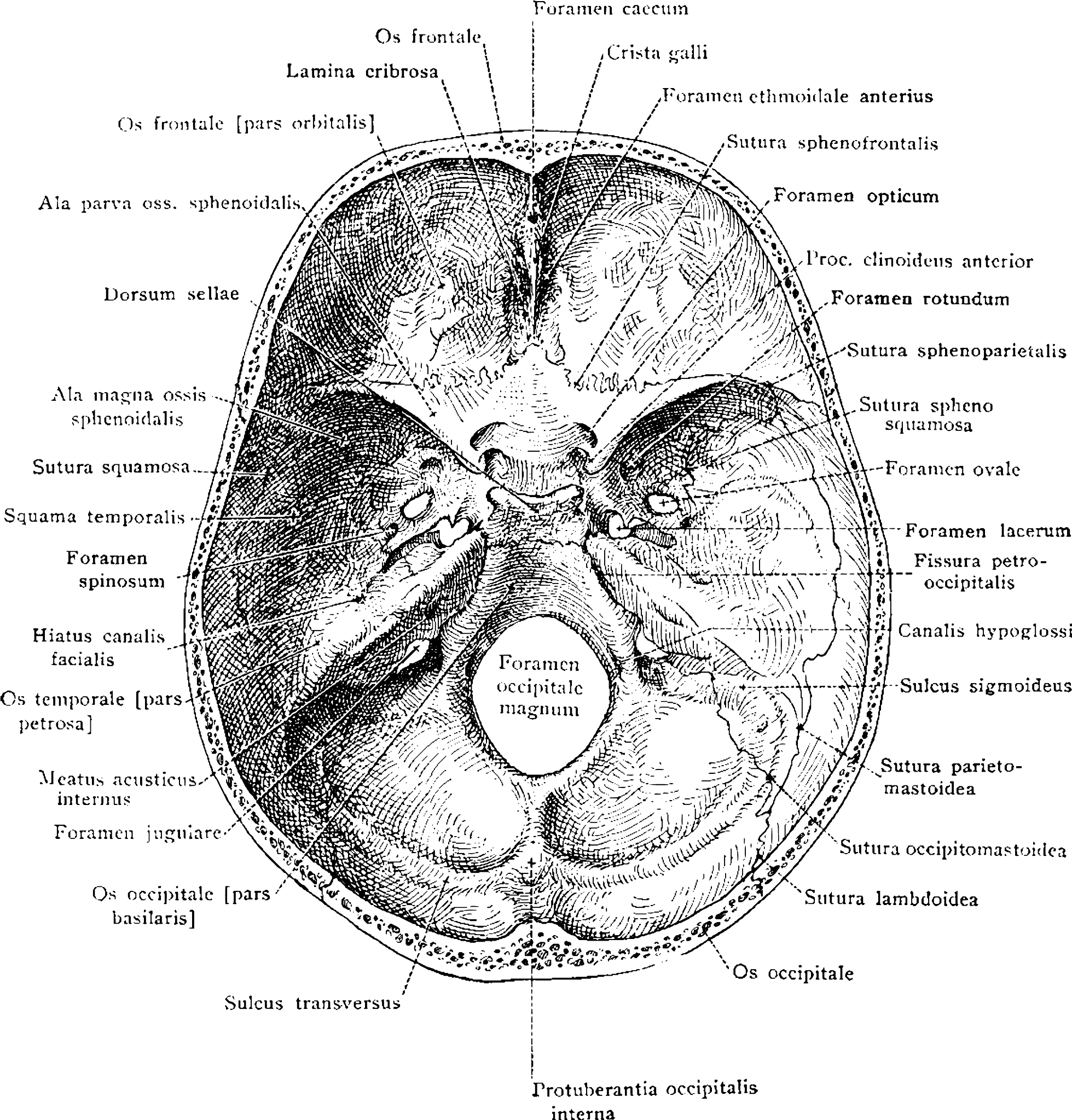 翻译Hepatic encephalopathy HEThe incidence of HE after TIPS varies from 15 to 48 48–55 Incontrolled trials comparing TIPS with medical treatment forvariceal bleeding the incidence of HE was always great