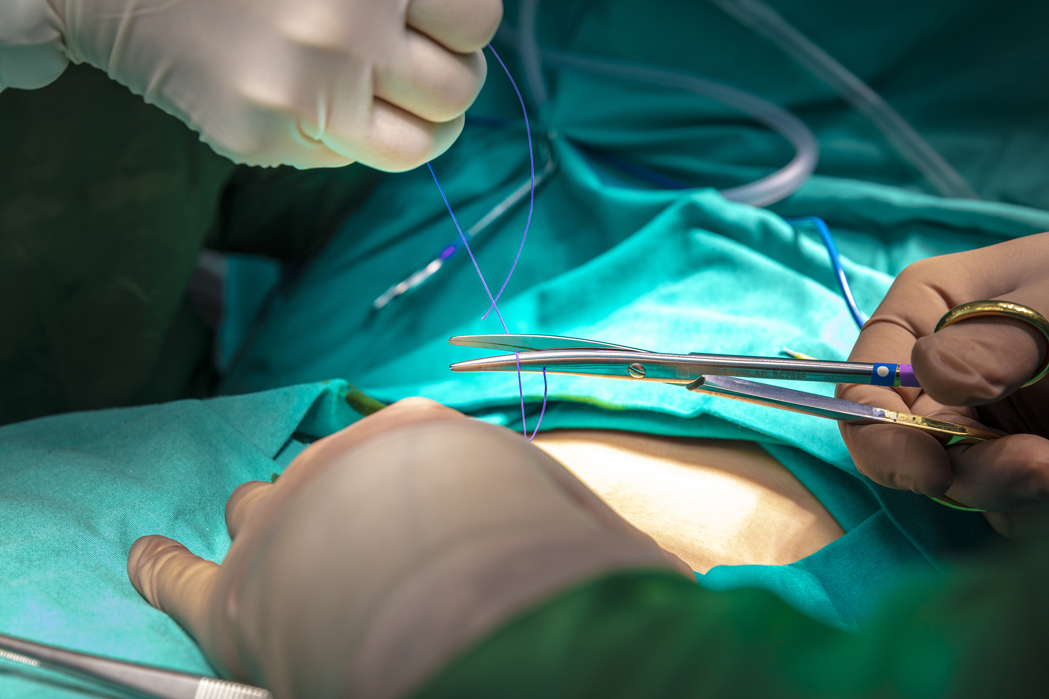 doctor make a surgical stitch