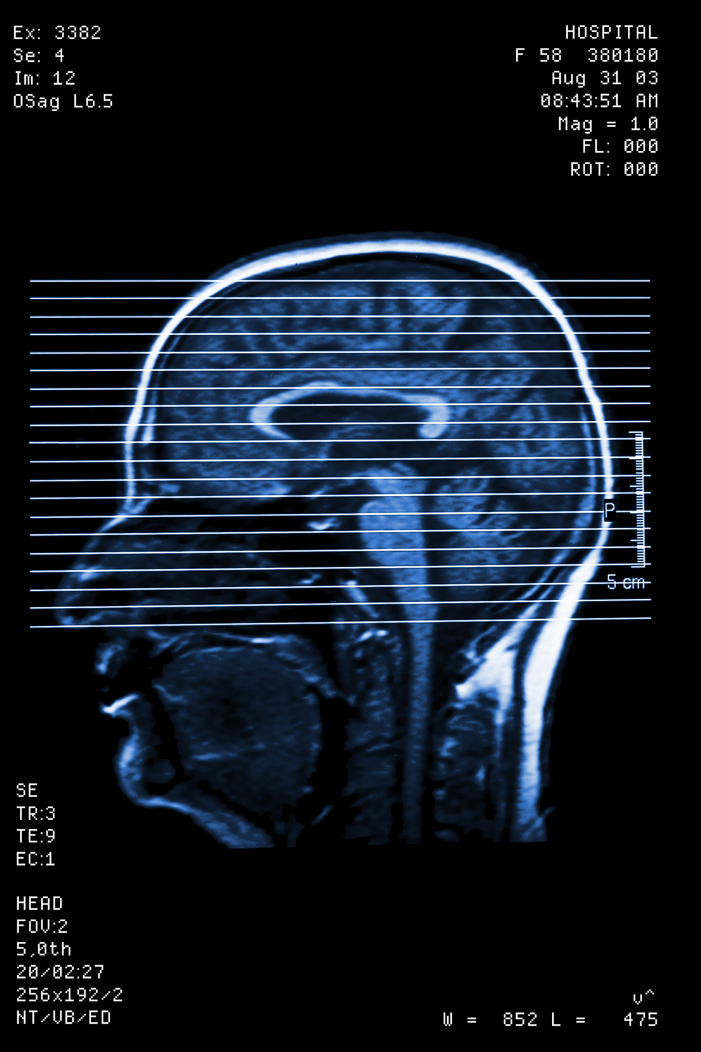 我想写一篇神经外科的病房日志