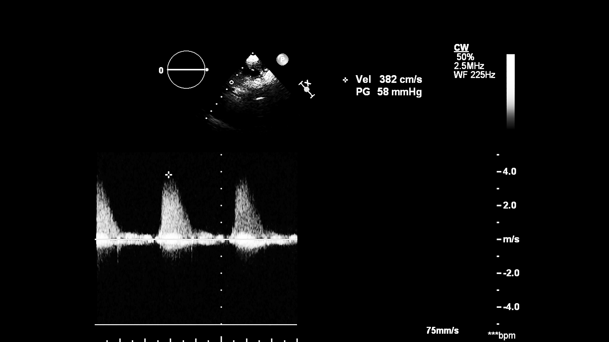 为什么能在体表测量到心电图？我们一般看到的体表心电图是心电信号的几次投影？心电图12导联的获得原理？什么是威尔逊网络？其中心点电位是否为0？为什么？心率和脉搏是同一概念吗？回答尽量详细