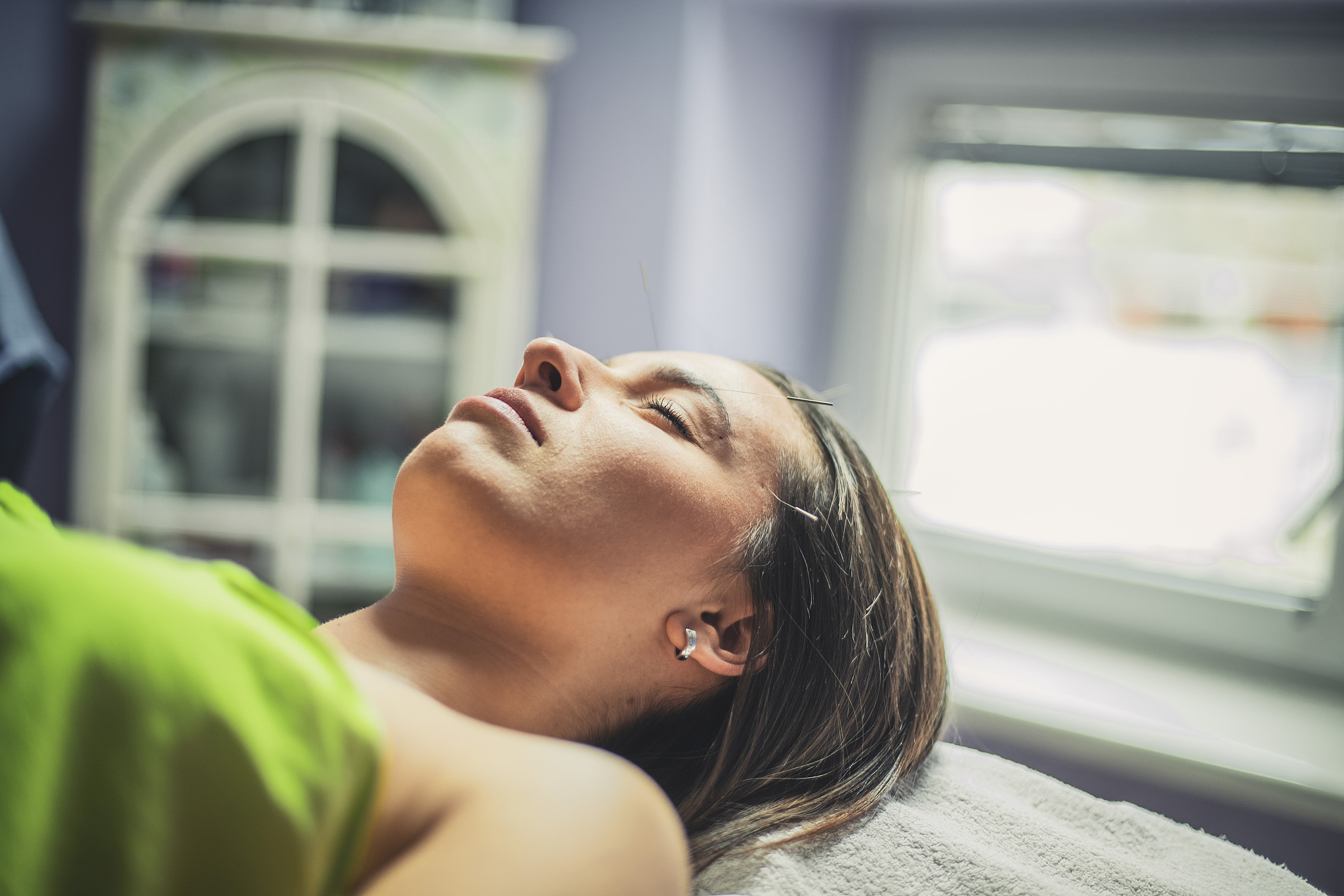 breaking free from everyday worries thanks to acupuncture