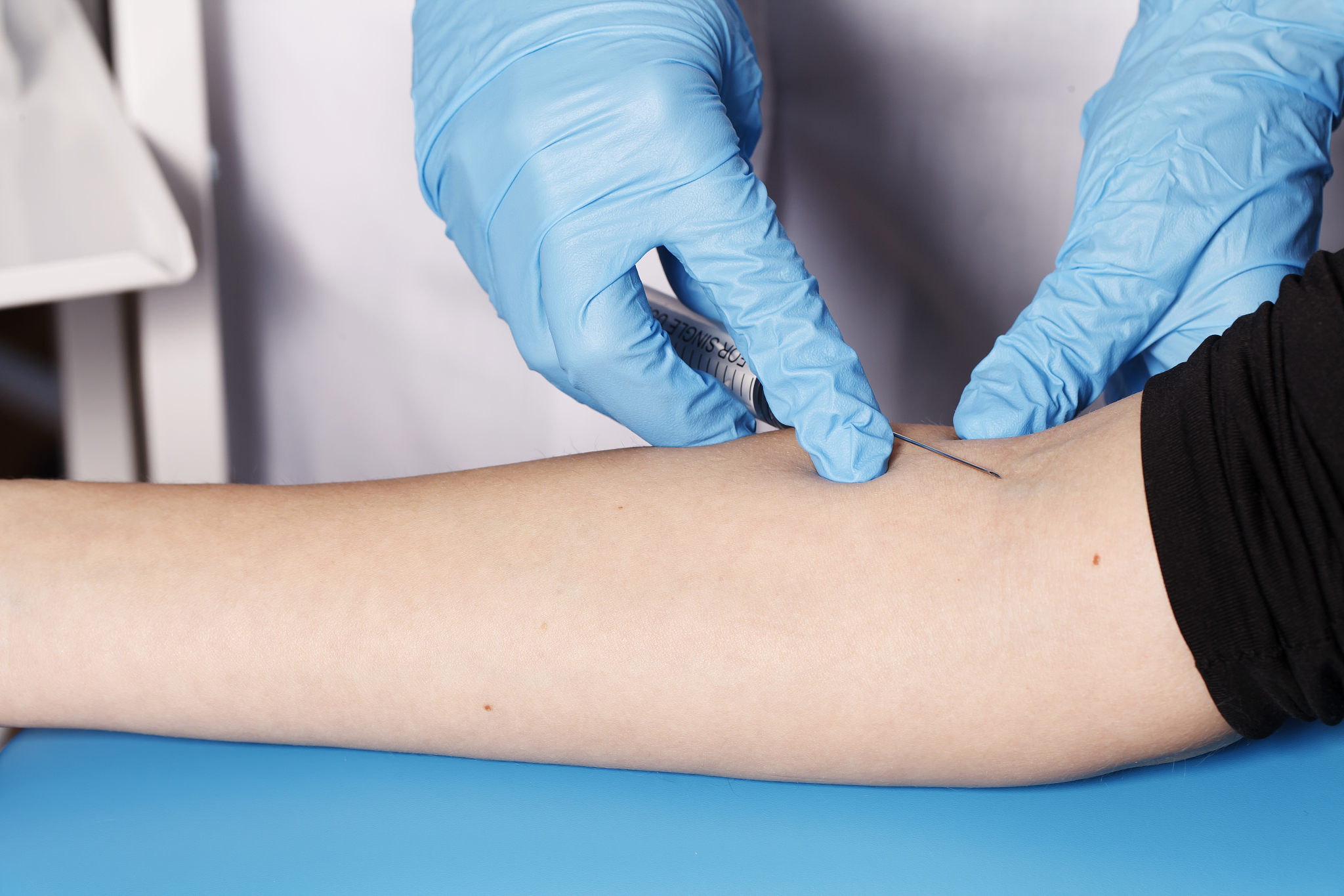 那些你以为不能但其实可以的吸脂部位。一腋下吸脂快夏天了腋下出汗比较多甚至可能会产生一些异味这种情况可以选择微创吸脂的方法来去除皮下的大汗腺组织得到一定程度的改善。二脚脖子没有脚脖子的腿就像狐里长出来的大萝卜一样在视觉上会显胖十斤。脚踝处如果脂肪堆积比较严重的话可以联合小腿做整体的塑形也会有很好的视觉效果。最后富贵包吸脂。富贵包是位于人体颈后部位比较厚的脂肪垫儿严重的富贵包会影响健康甚至影响生活虽然