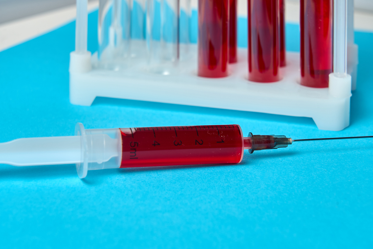 果纳纷注射笔打完淤血