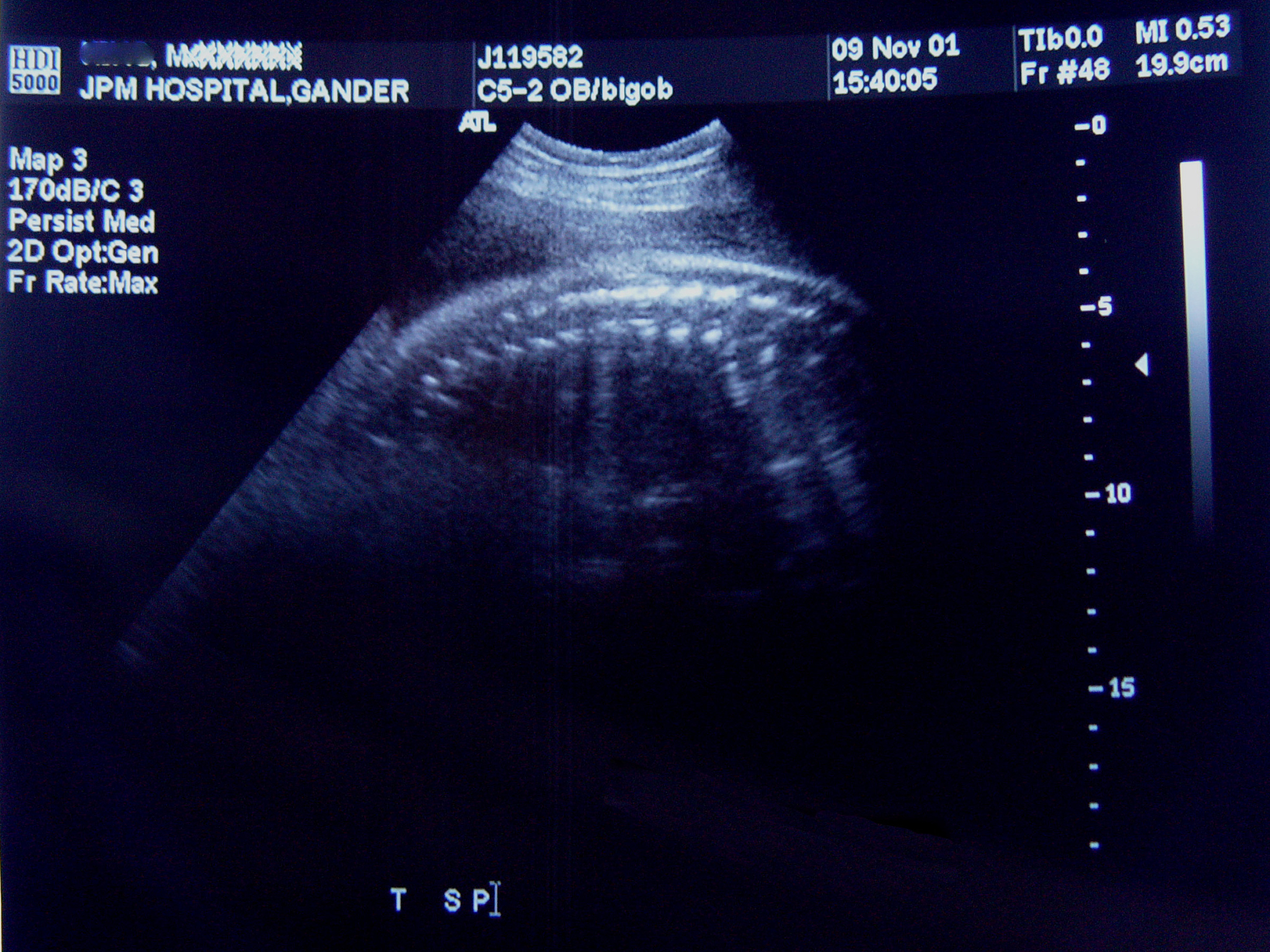 成年女性后盆腔肌性组织结构超声测量：硕士论文答辩问题