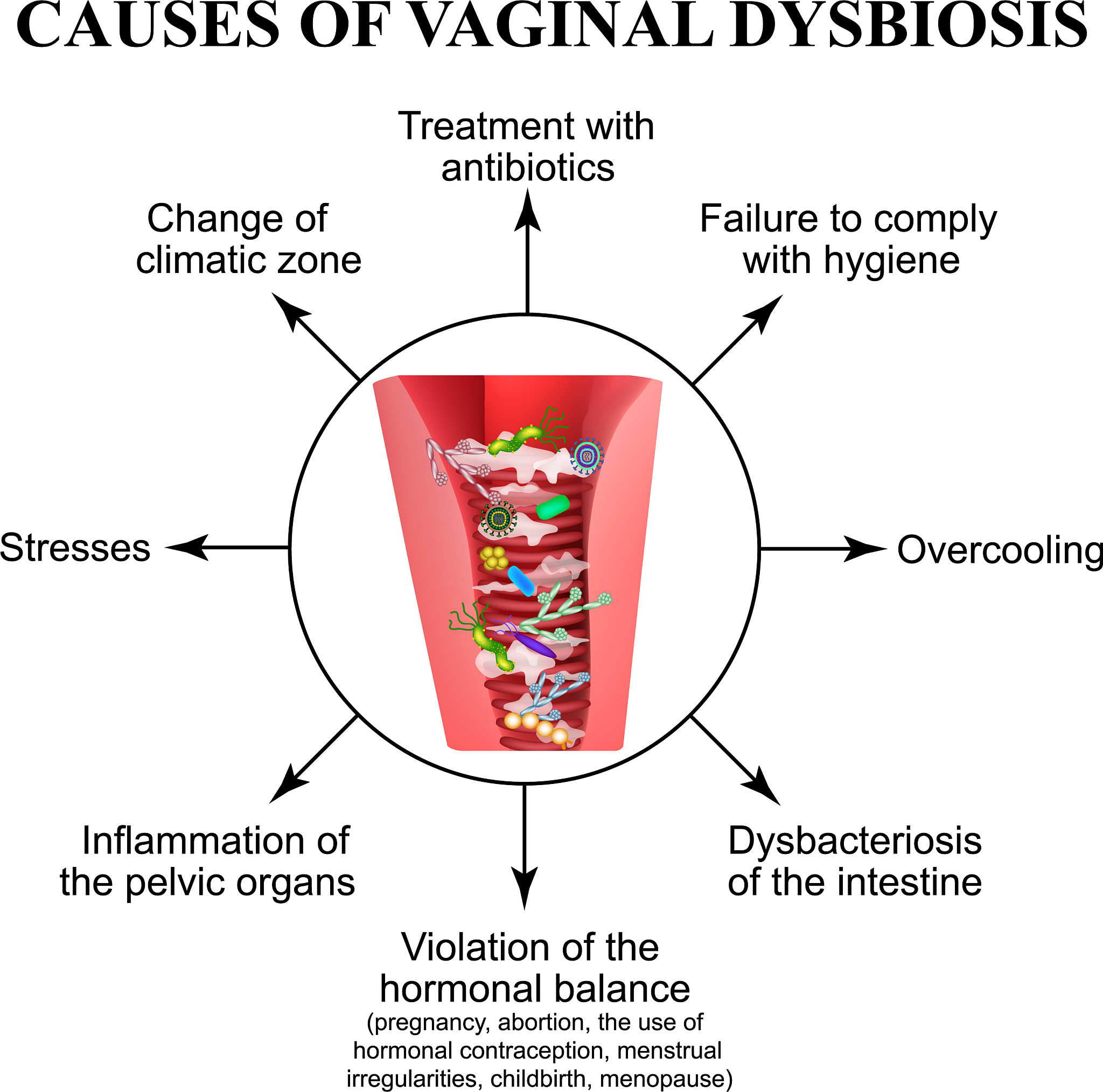 Irritable bowel syndrome IBS is a functional gastrointestinal disorder characterized by abdominal pain and changes in bowel habits The diarrhea-predominant subtype IBS-D is the most common form of IBS