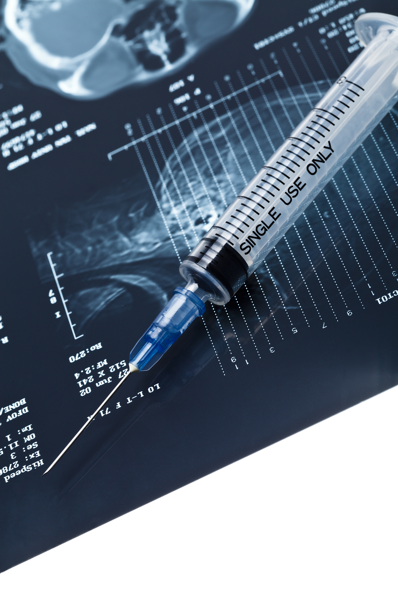 普洱卫生学校医学影像技术专业怎么样