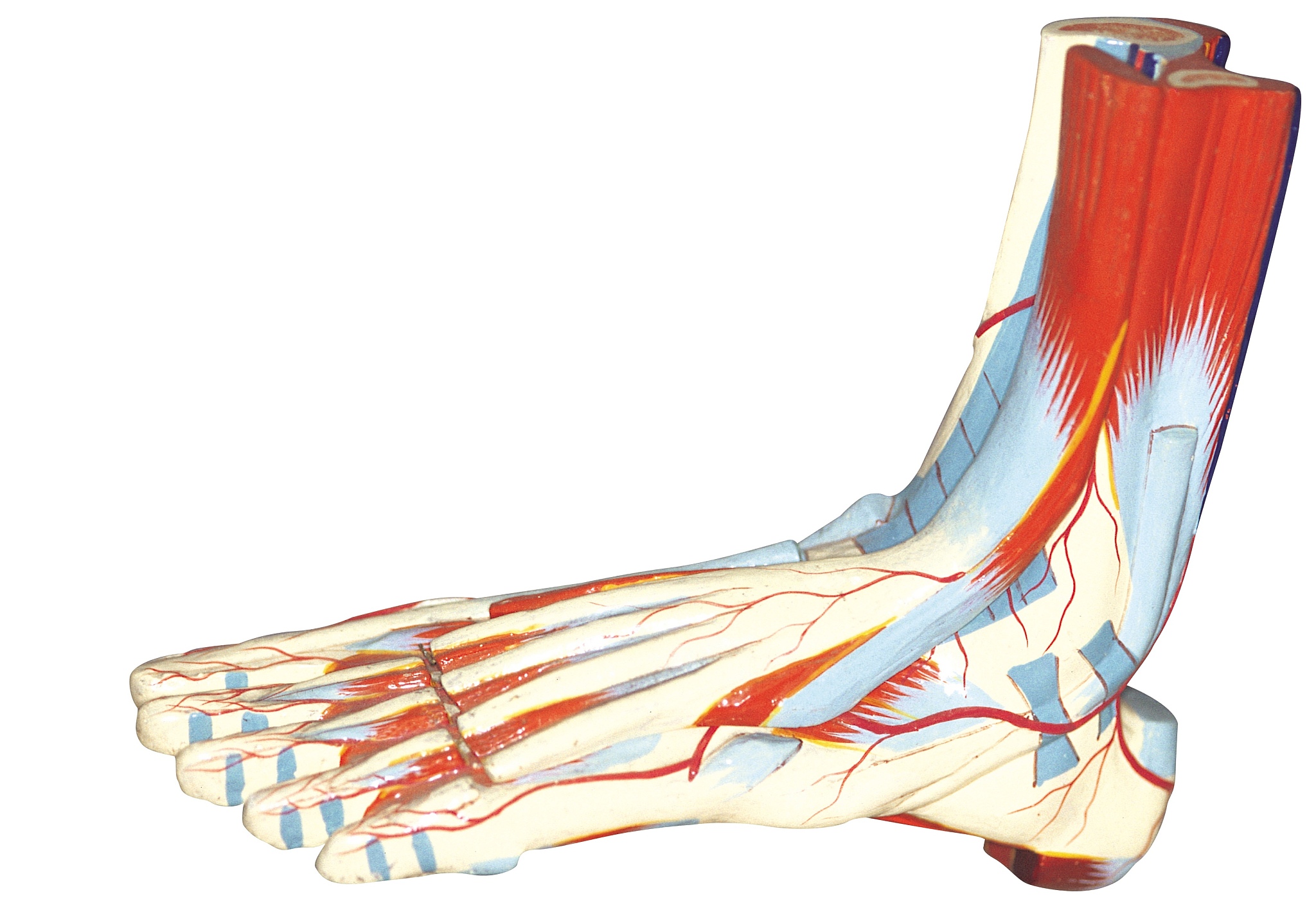 踝关节韧带解剖重建方法：Broström手术及改良术式