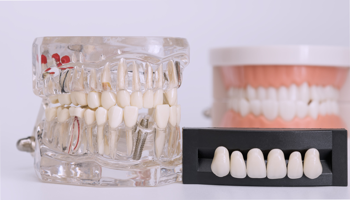 2023年报读口腔修复工艺专业怎么样