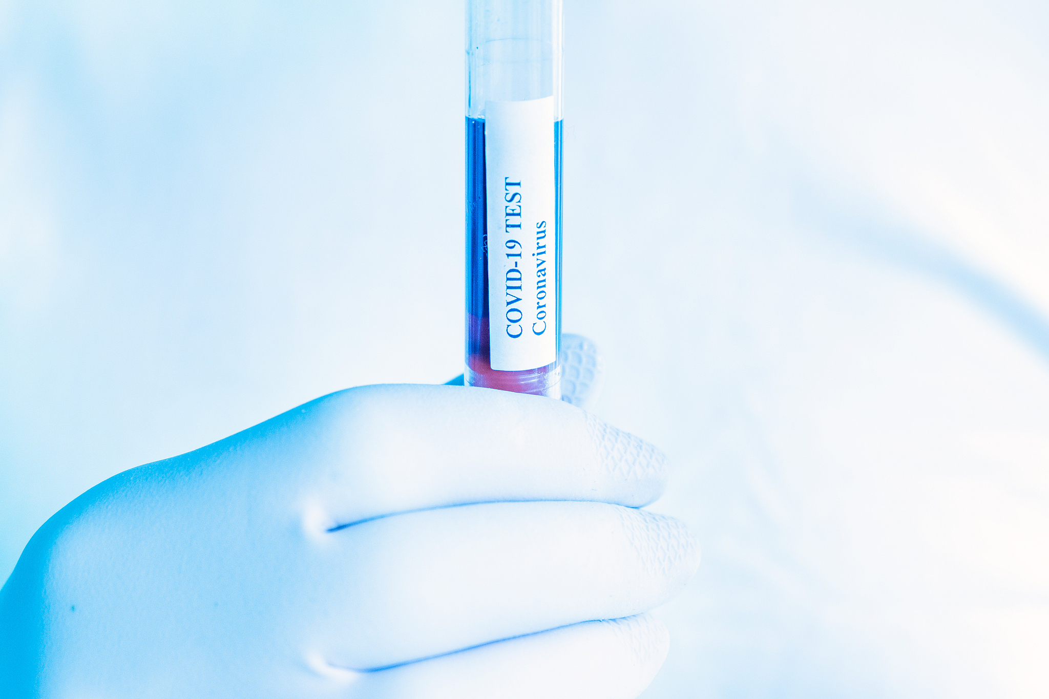 coronavirus test in laboratory