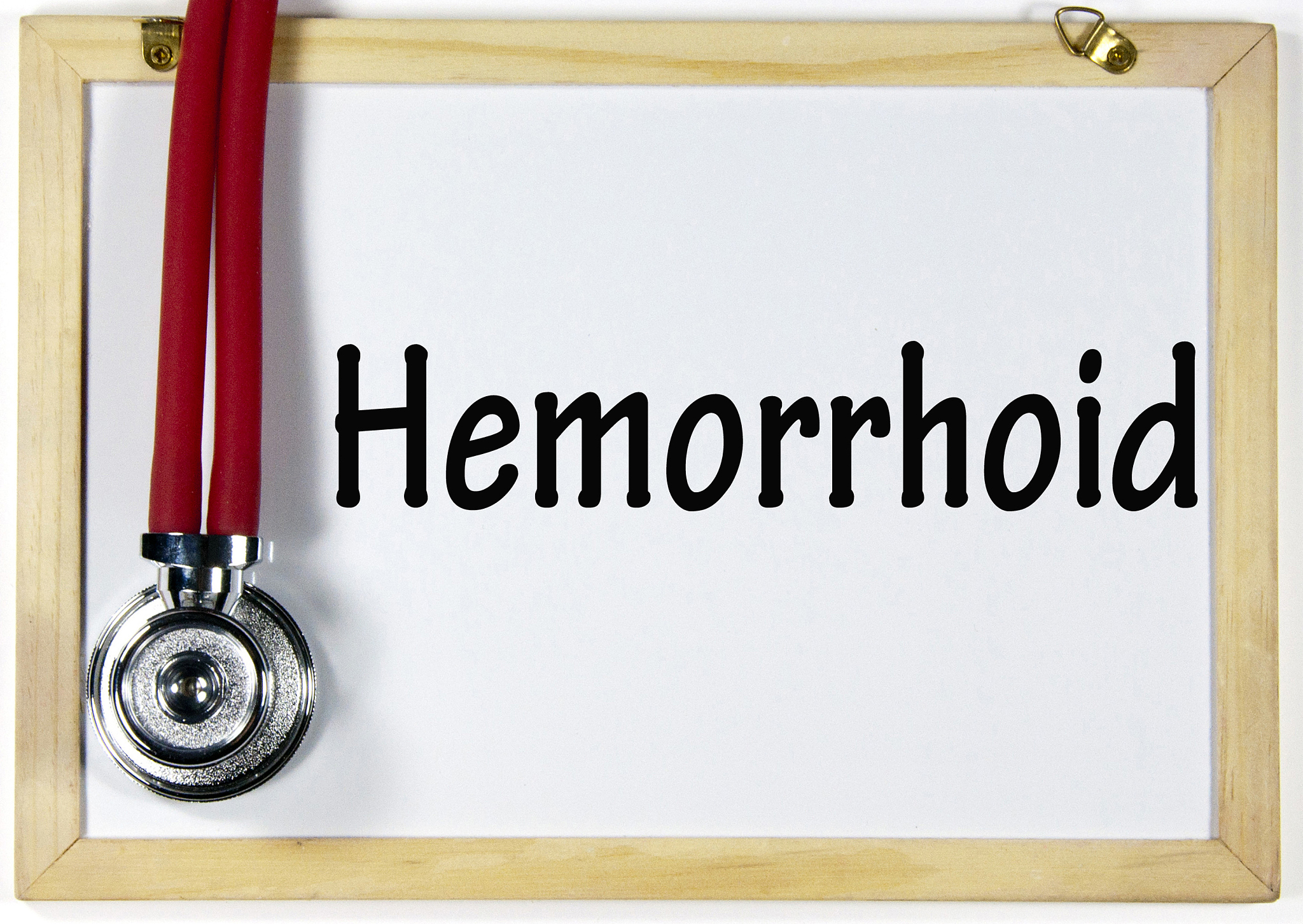 hemorrhoid
