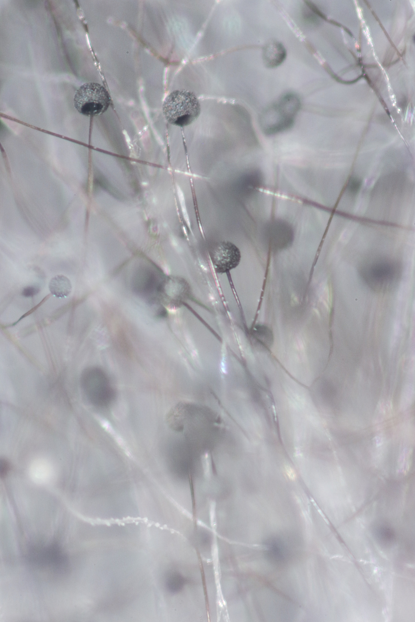 针对一下霉菌写一份观察他们显微镜结果的结论以及共同的结论 1、青霉 2、曲霉 3、黑根霉 4、匍枝根霉5、面包霉 6、有隔菌丝 7、无隔菌丝