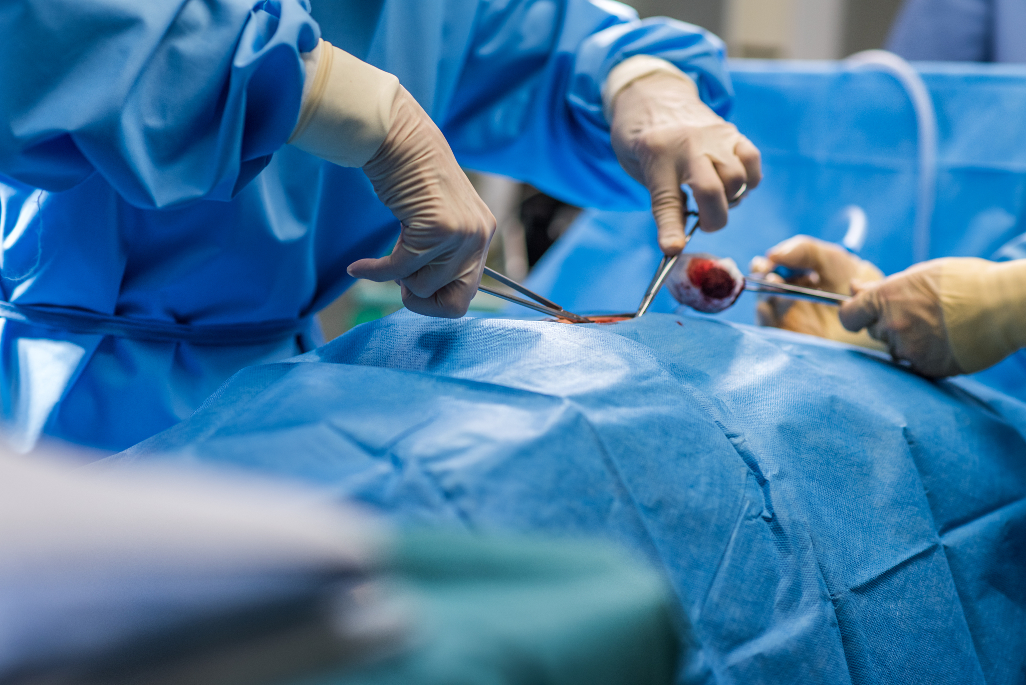 surgeons performing surgery