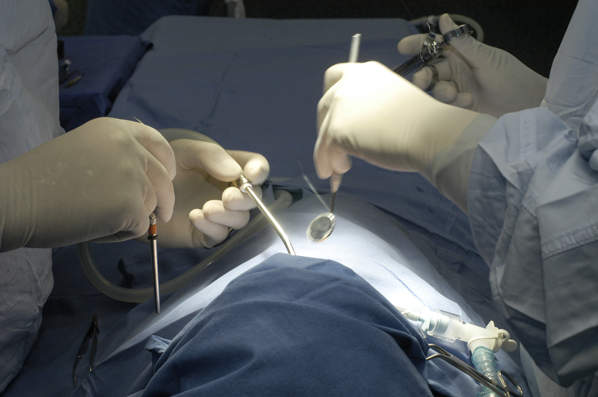 hands of surgeon in operating room
