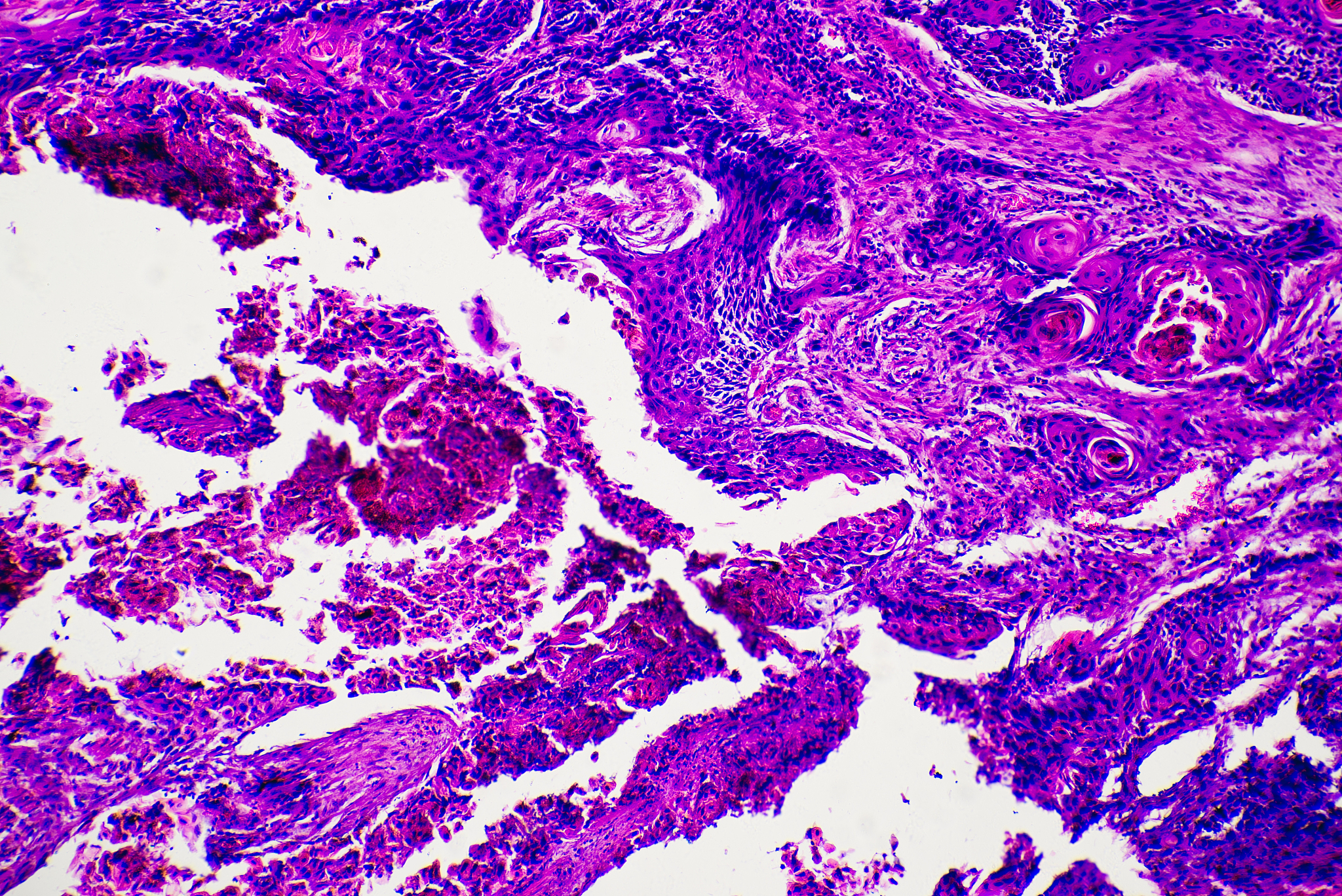 Breakhis数据库 简介