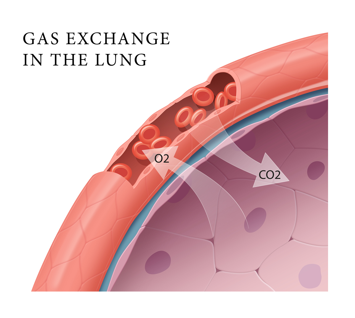 不稳定型心绞痛病因详解：从冠心病到生活习惯