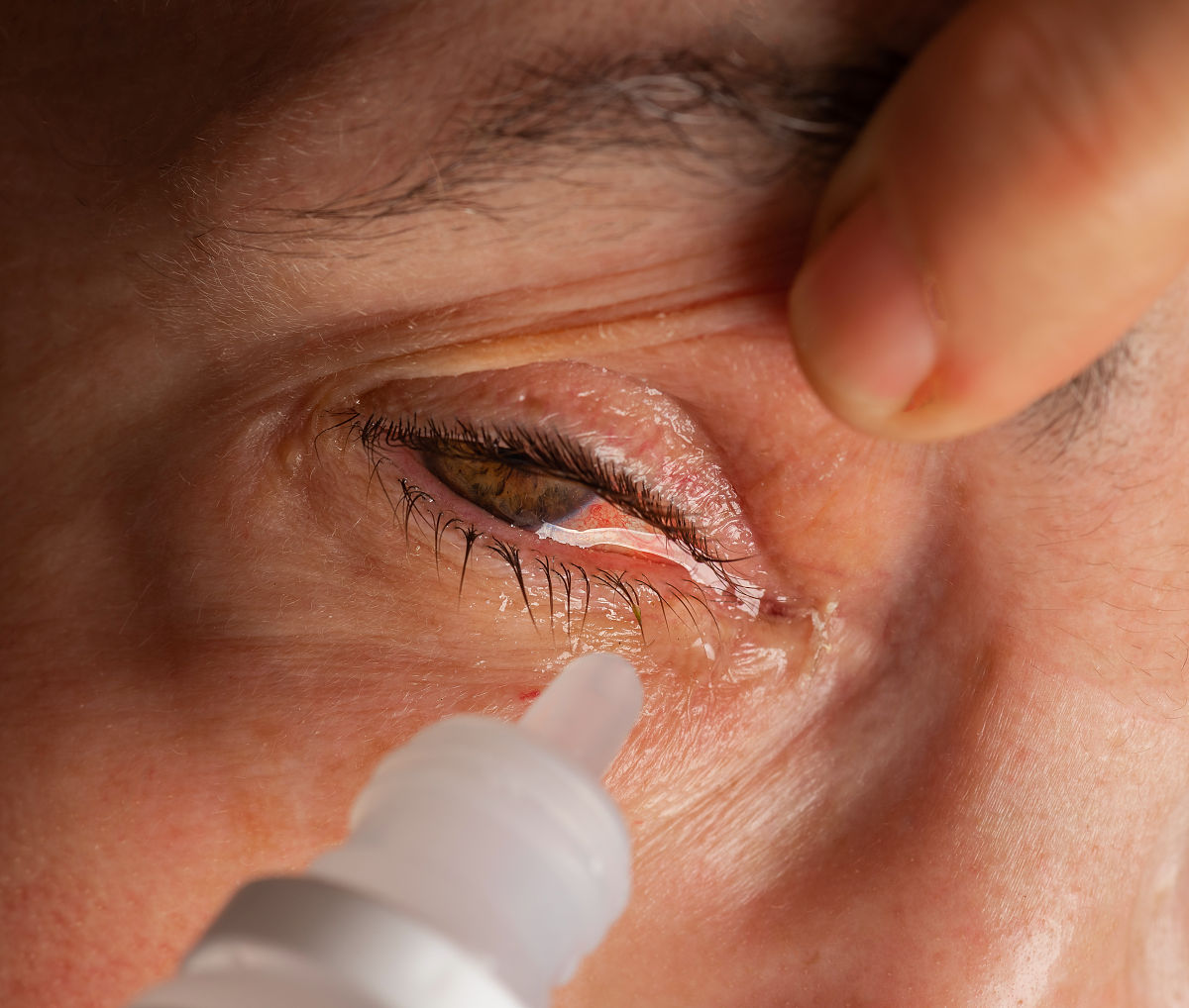 普通眼药水用途：缓解眼部不适和问题