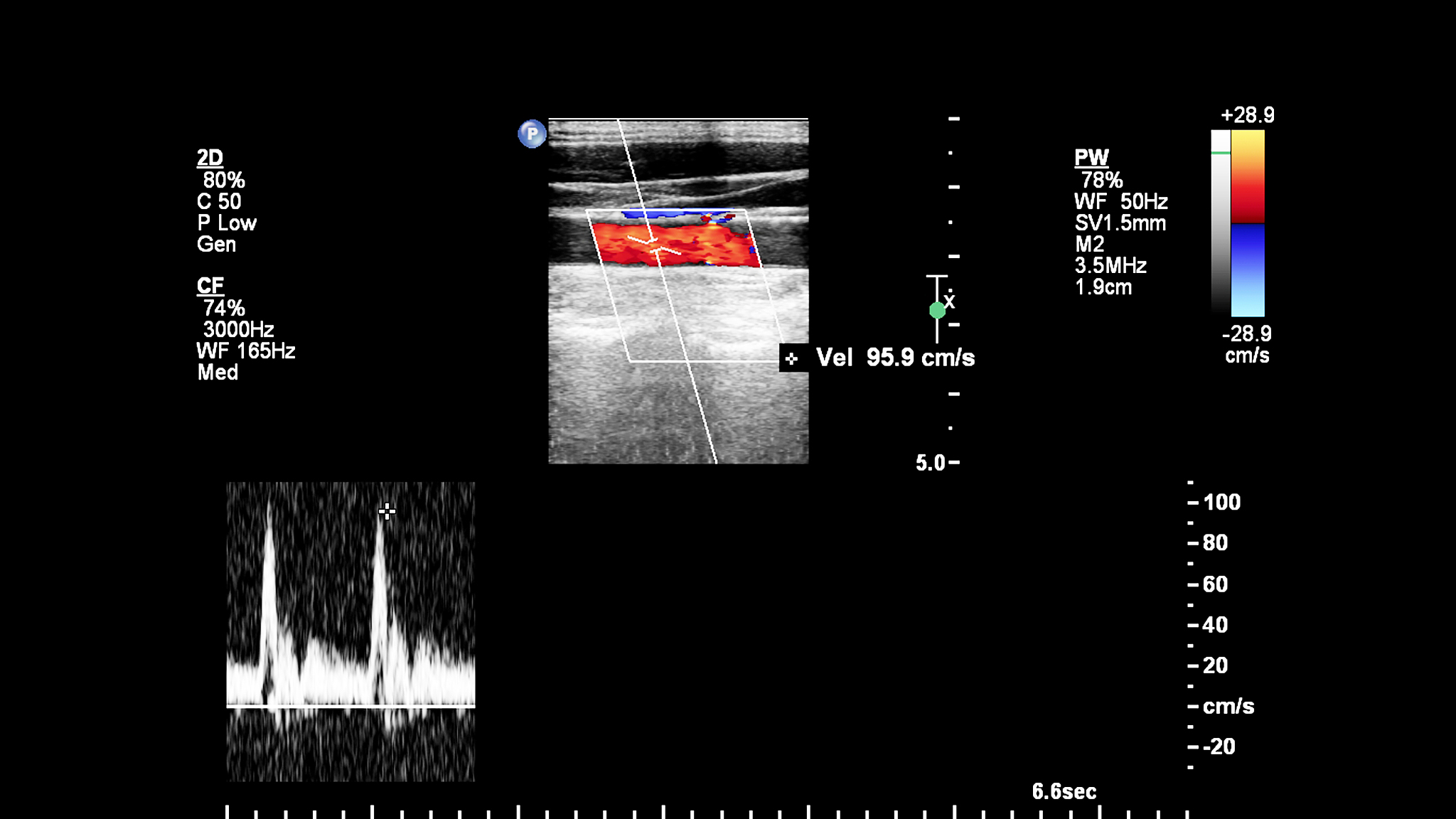 This academic abstract discusses the DSRD device which is based on the ionization wave theory invented by Professor Grekhov and others The device uses a multi-layered pn structure to achieve fast turn
