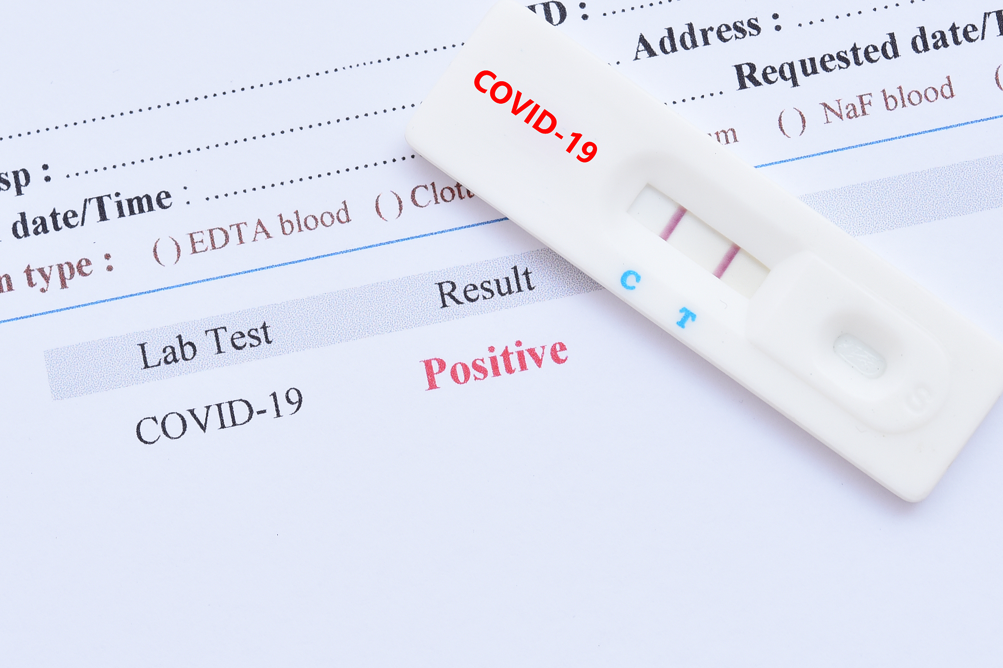 陕西省高教系统职业中等专业学校医学检验技术专业怎么样？好不好