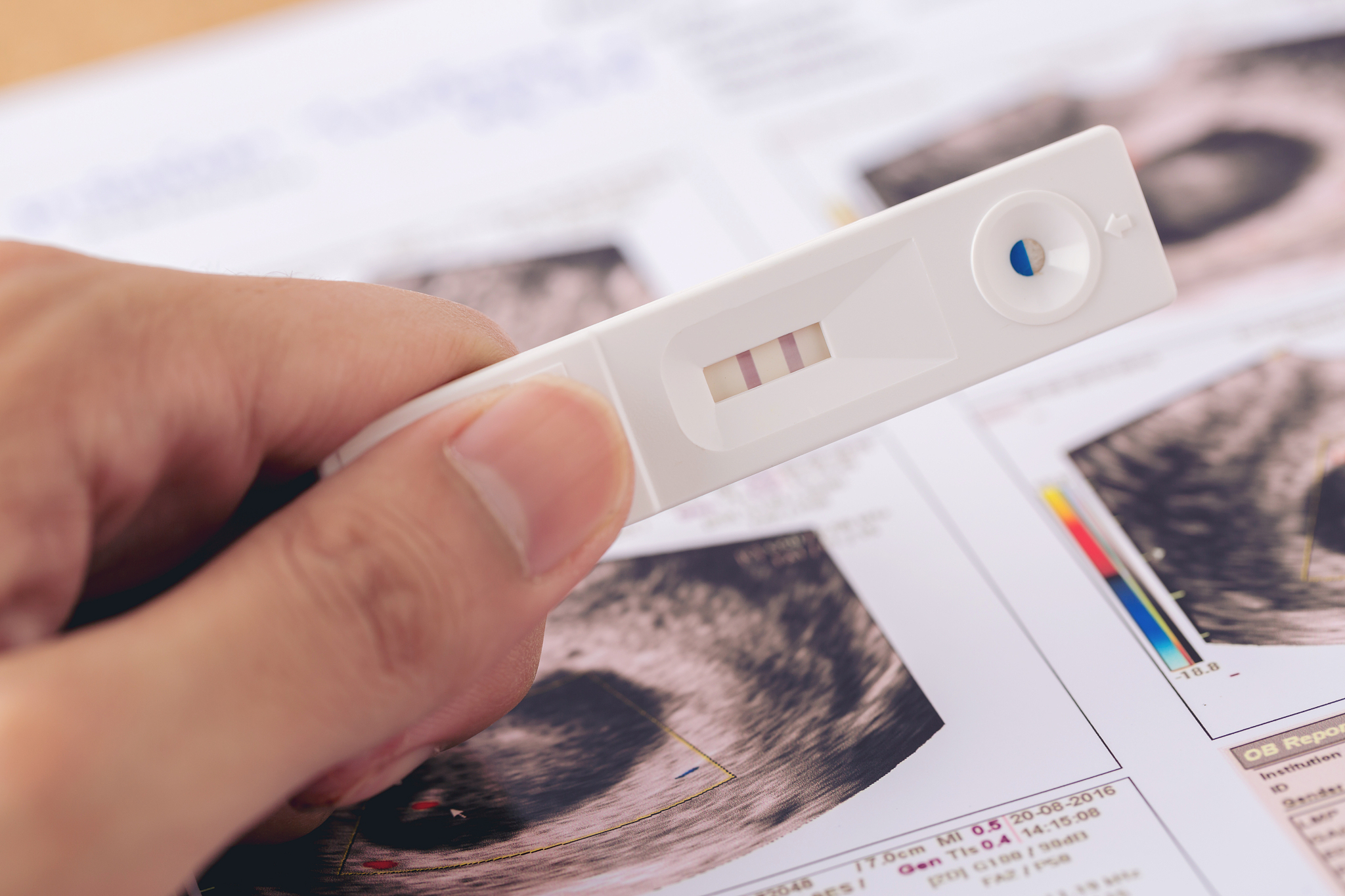 超声报告描述：肝脏实质回声增强。对应的超声诊断是？