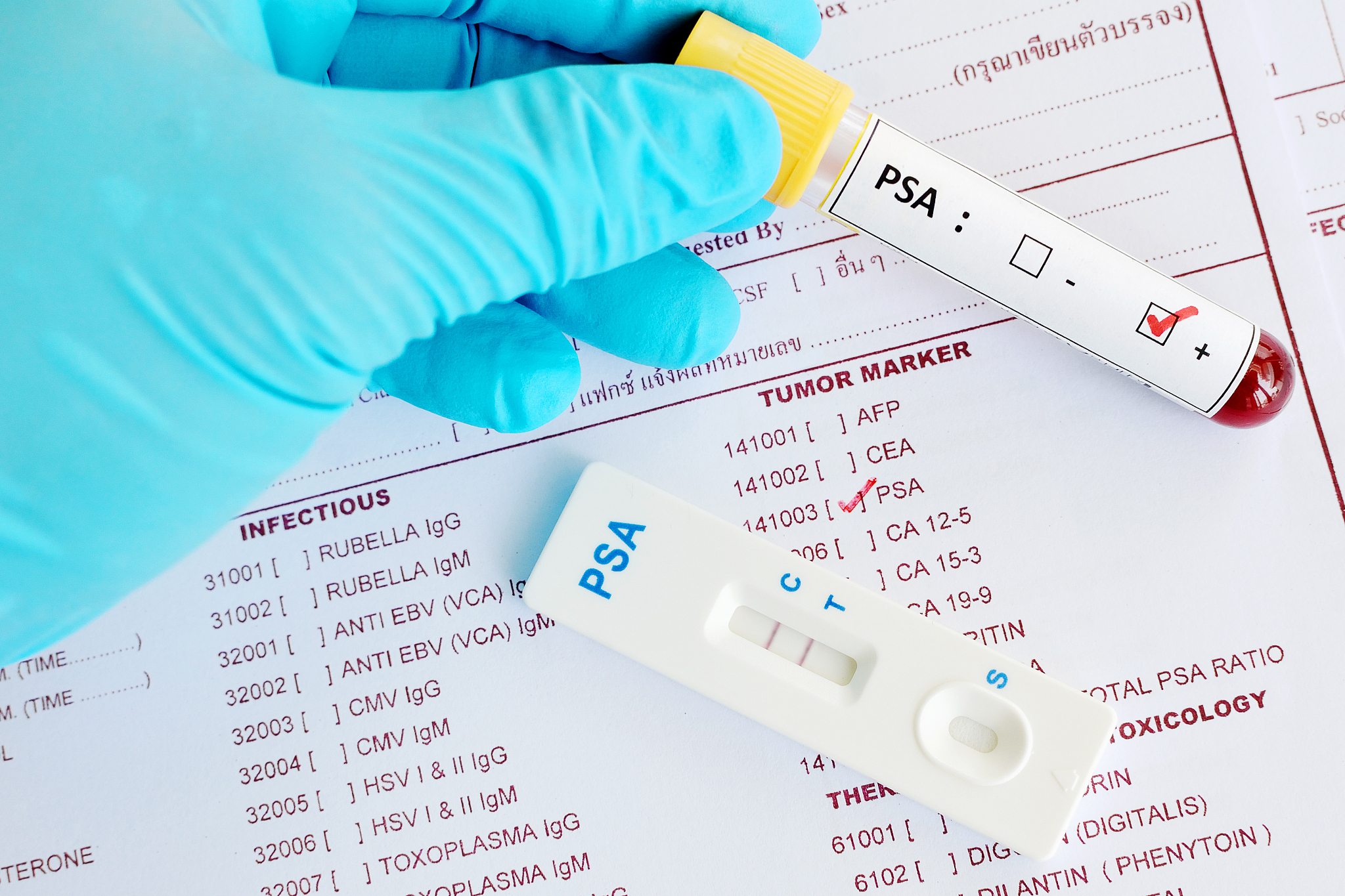 Glucoraphanin 抗体：检测和定量分析