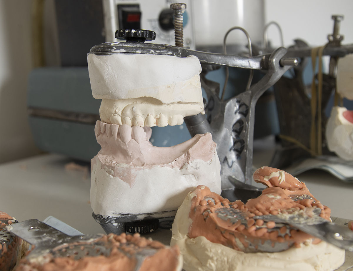 上颌中切牙的雕刻？