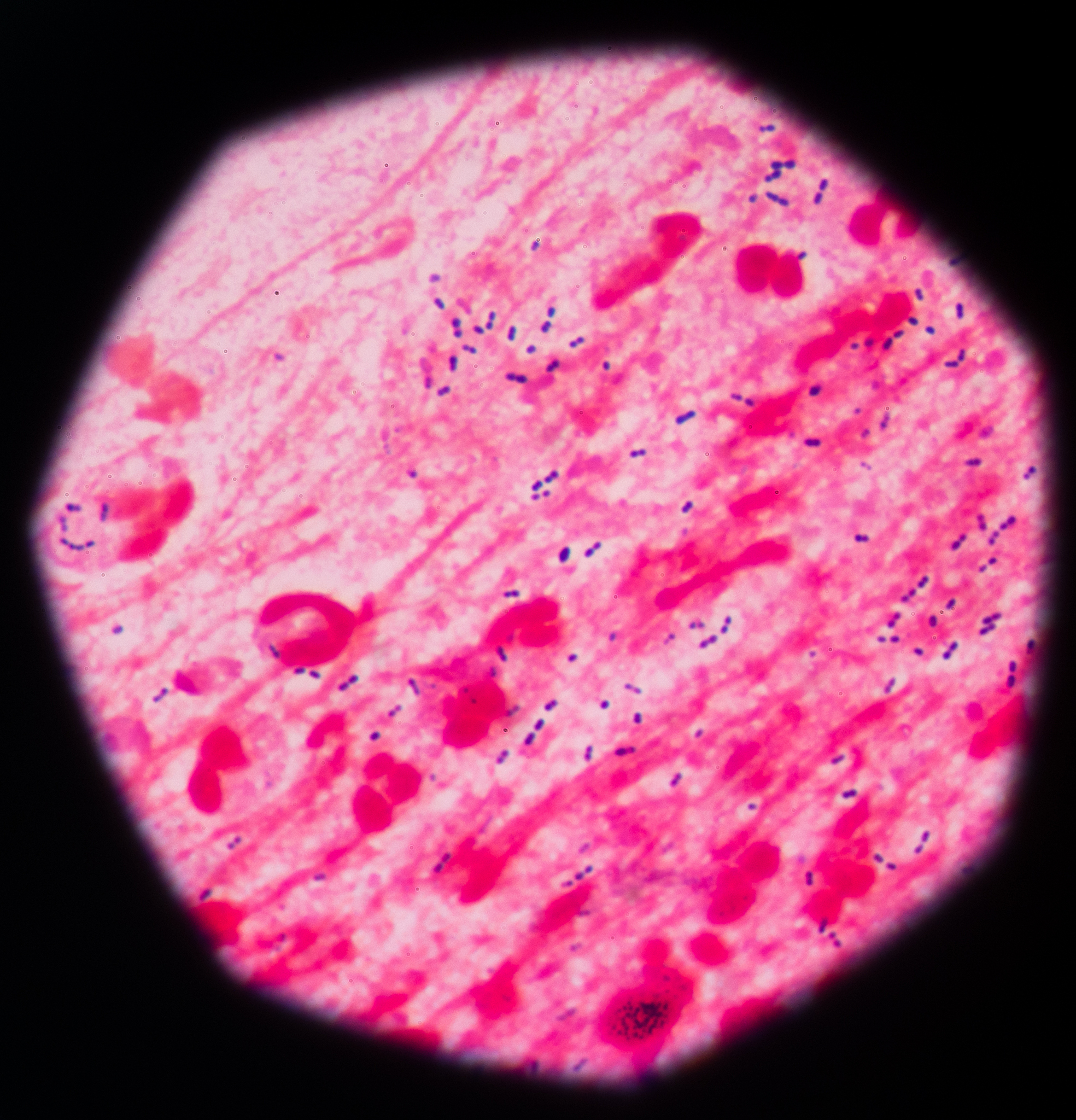 灵菌红素如何增加感染金黄色葡萄球菌的小鼠肠道中厚壁菌门的相对含量？