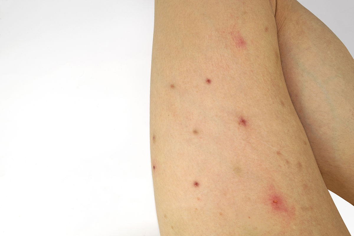 怎么对付揭人伤疤的人