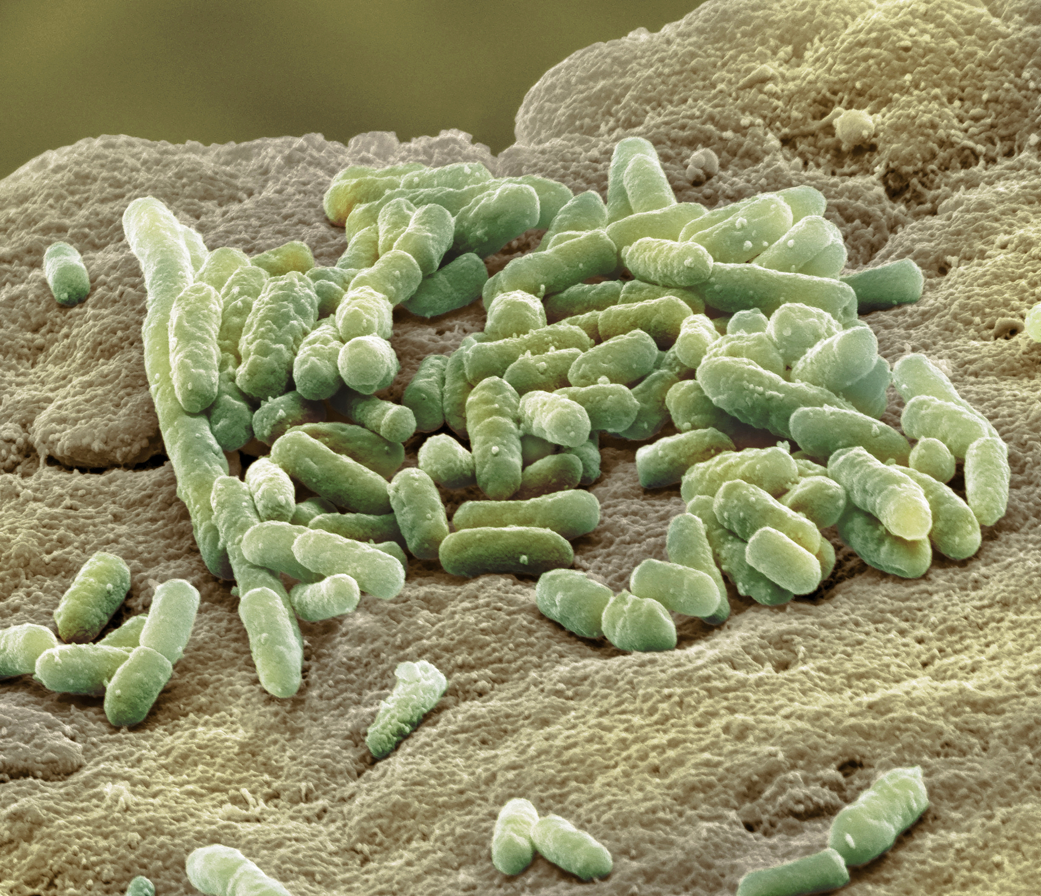 写一个关于活动性肺结核的医学科普