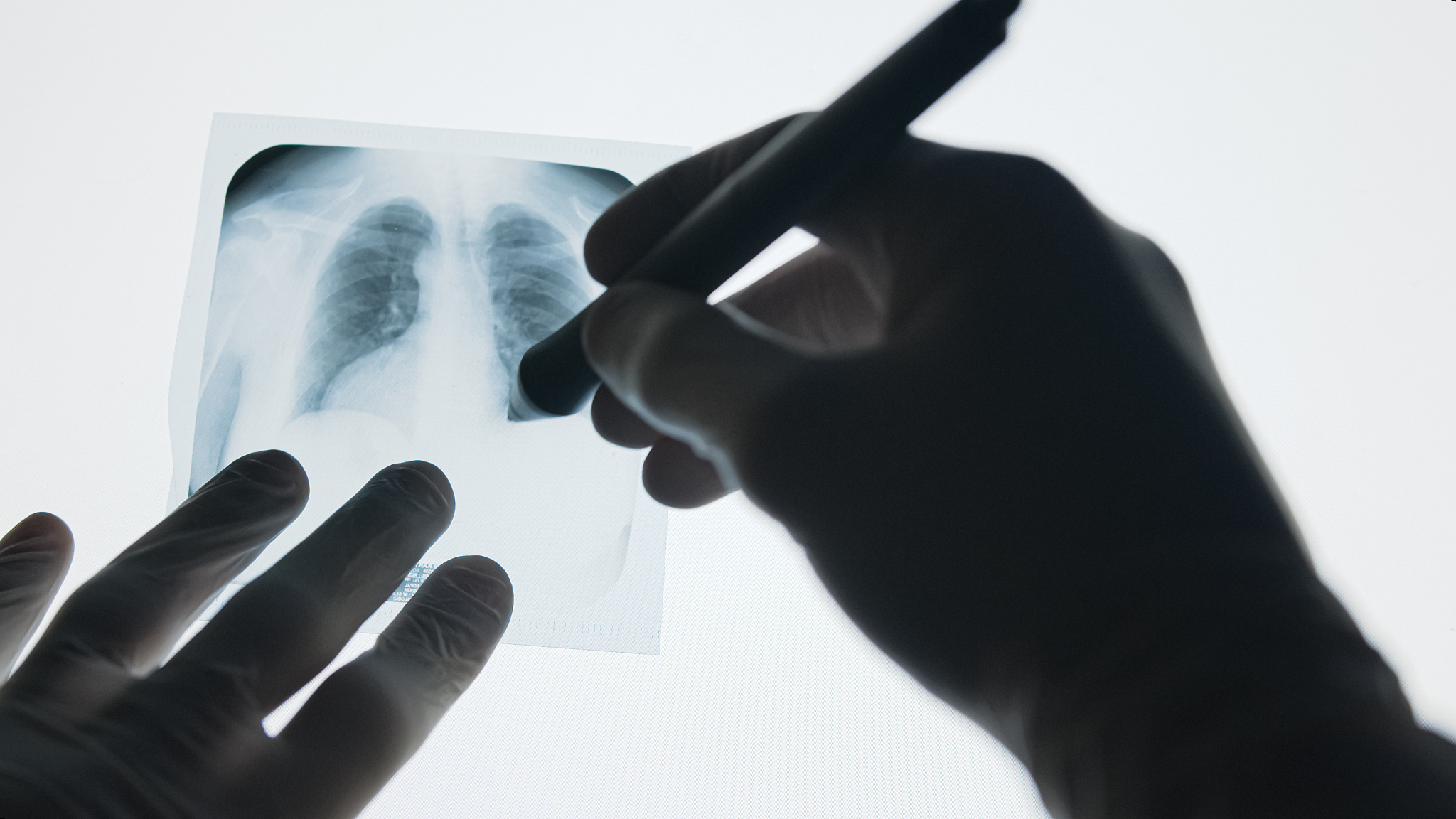 清镇市卫生职业技术学校怎么样？好不好？就业方向及发展前景