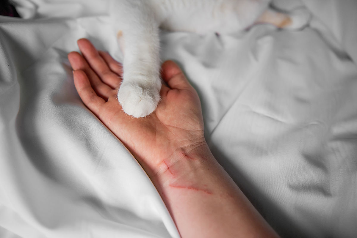 被猫抓伤手，伤口很浅要紧吗？如何处理？
