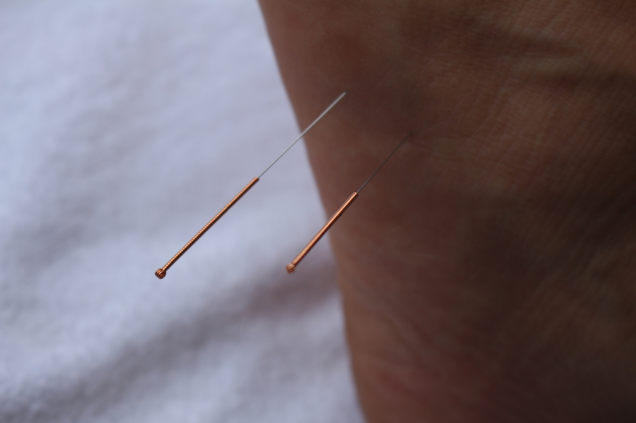 close-up of needle on hand
